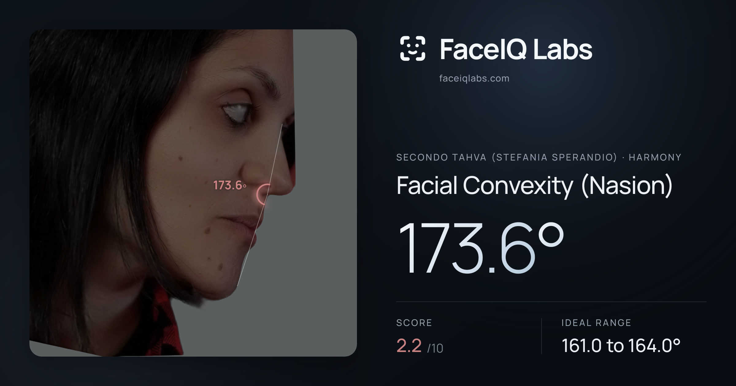Secondo Tahva (Stefania Sperandio) Facial Convexity (Nasion): 173.6°, drawn on the photo