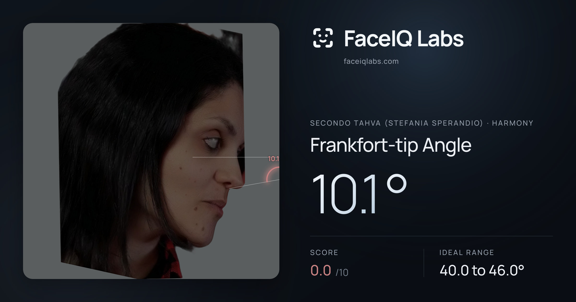 Secondo Tahva (Stefania Sperandio) Frankfort-tip Angle: 10.1°, drawn on the photo