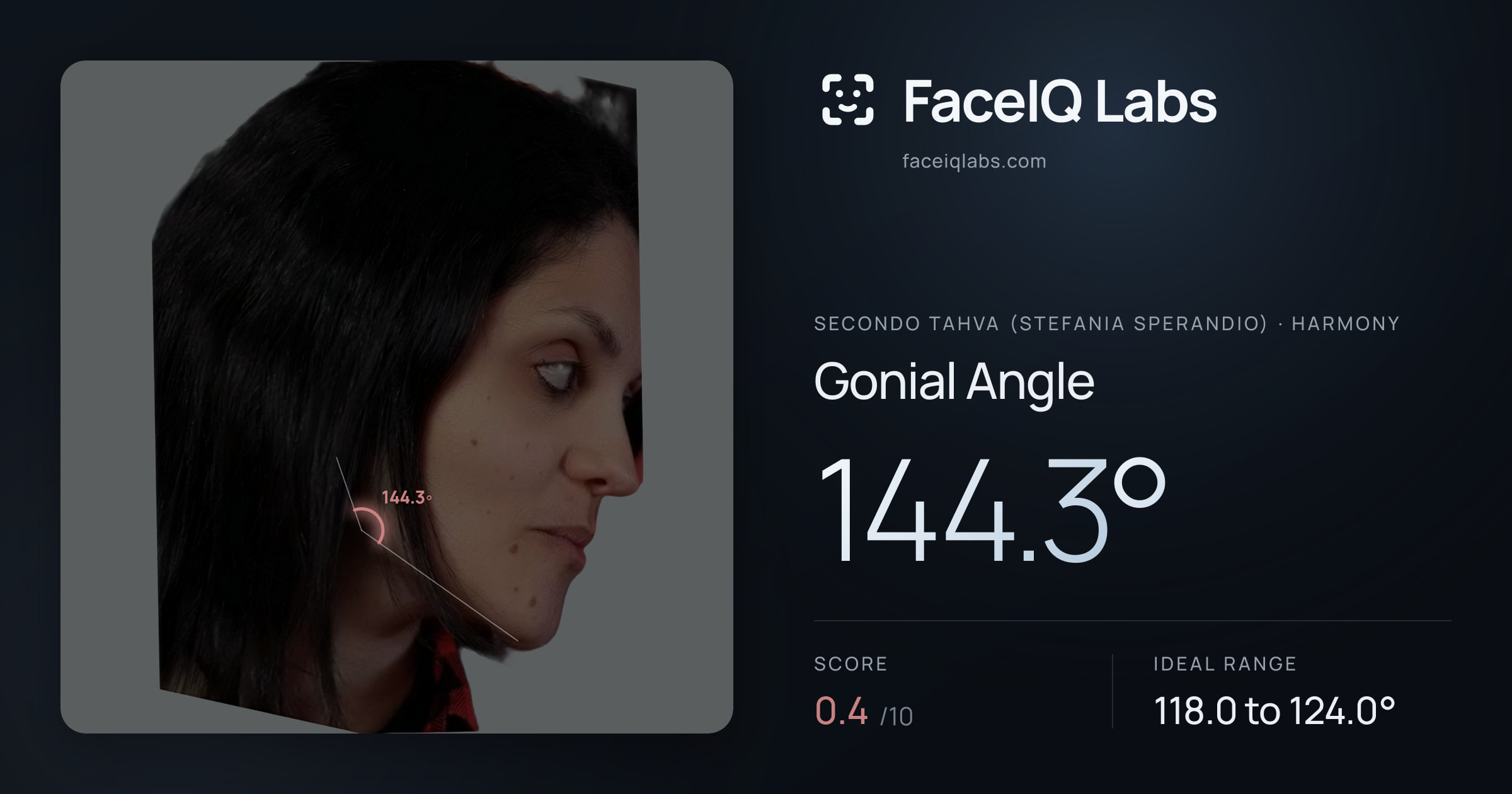 Secondo Tahva (Stefania Sperandio) Gonial Angle: 144.3°, drawn on the photo