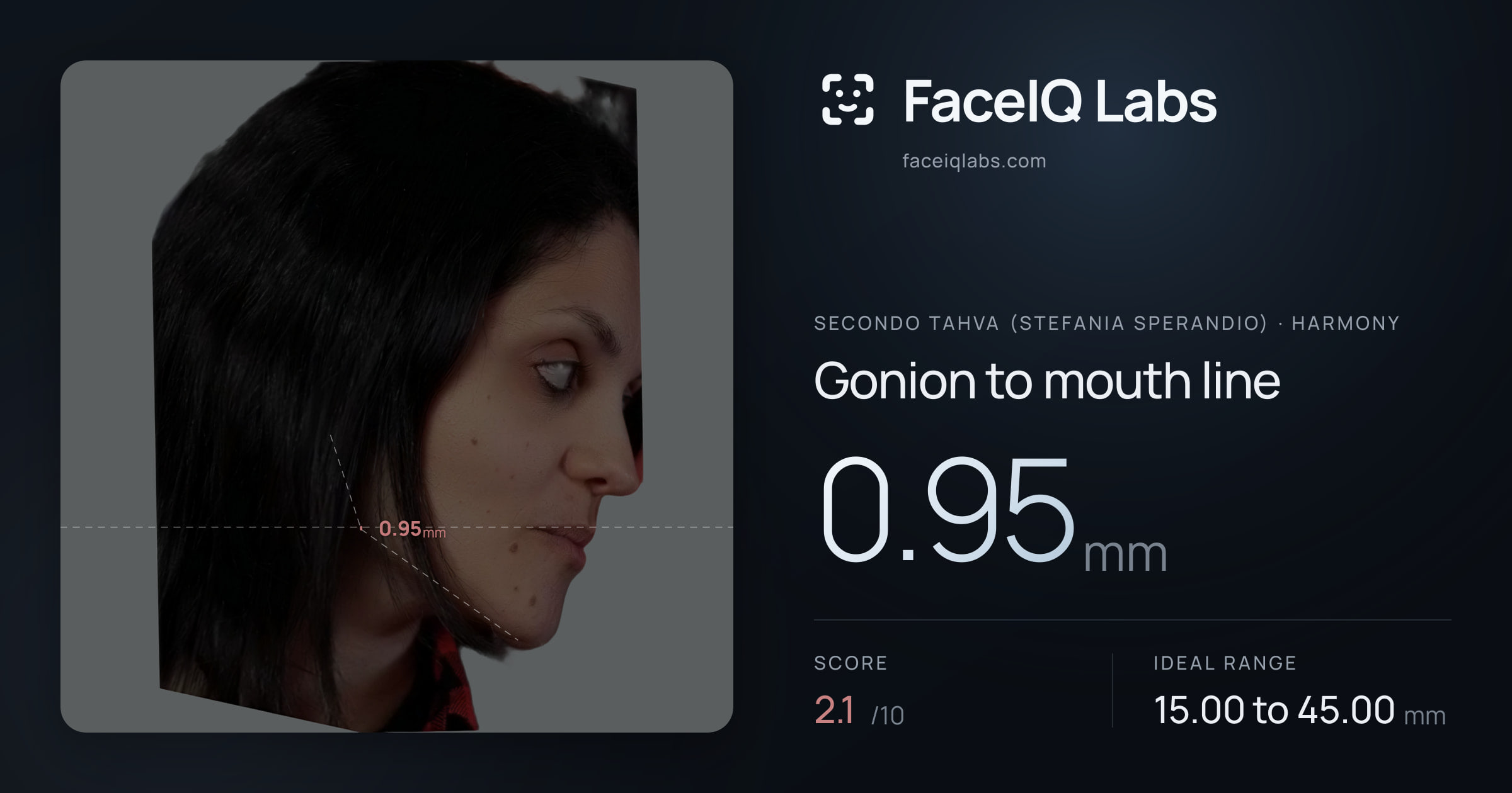 Secondo Tahva (Stefania Sperandio) Gonion to mouth line: 0.95mm, drawn on the photo