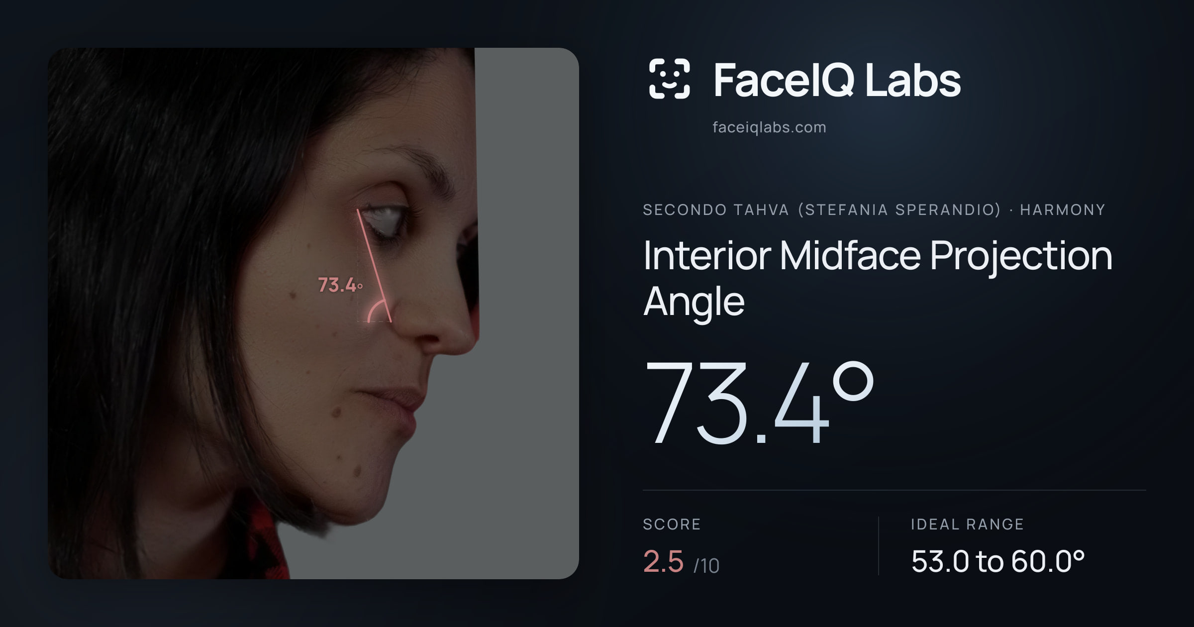 Secondo Tahva (Stefania Sperandio) Interior Midface Projection Angle: 73.4°, drawn on the photo