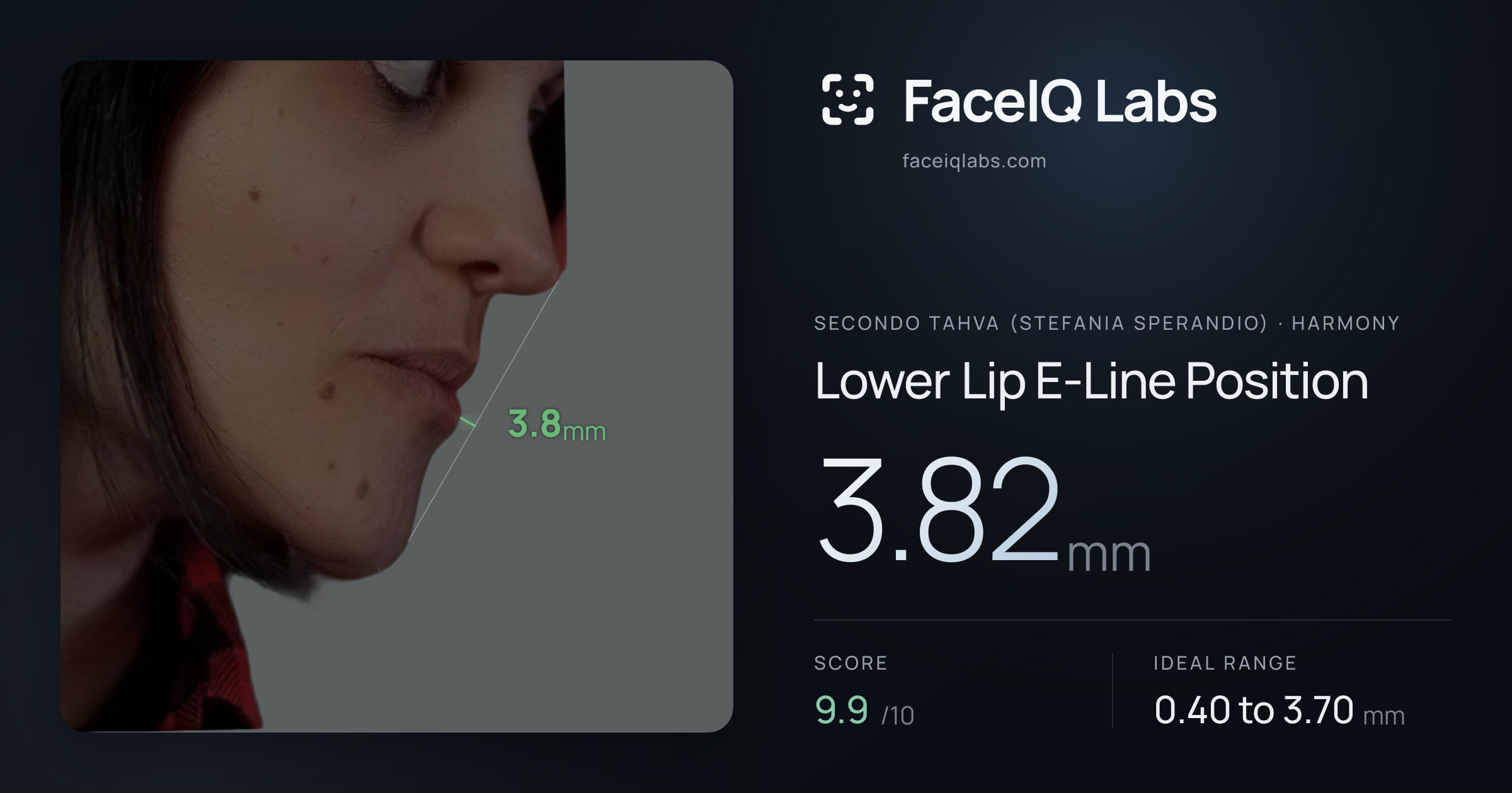 Secondo Tahva (Stefania Sperandio) Lower Lip E-Line Position: 3.82mm, drawn on the photo