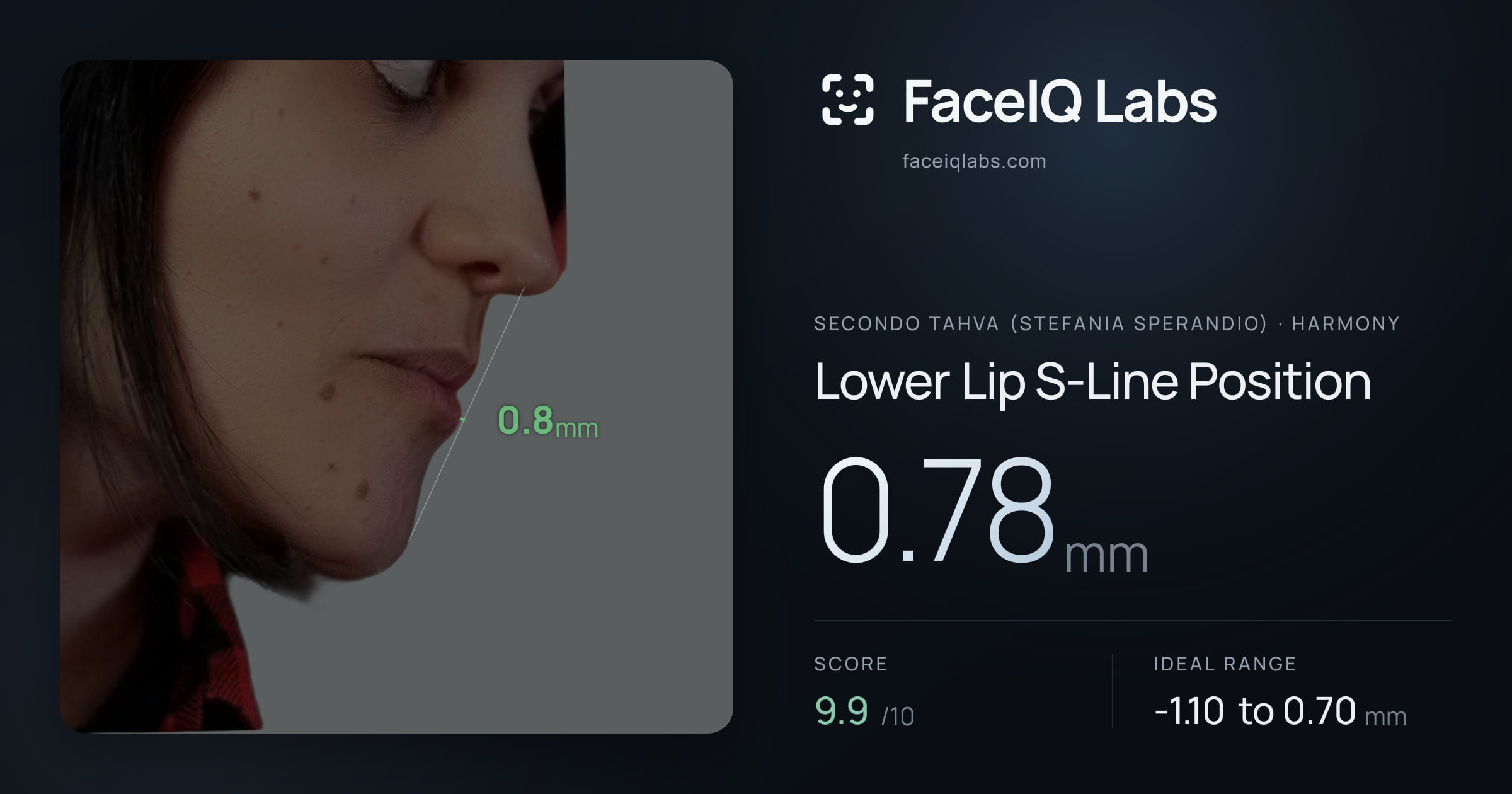 Secondo Tahva (Stefania Sperandio) Lower Lip S-Line Position: 0.78mm, drawn on the photo