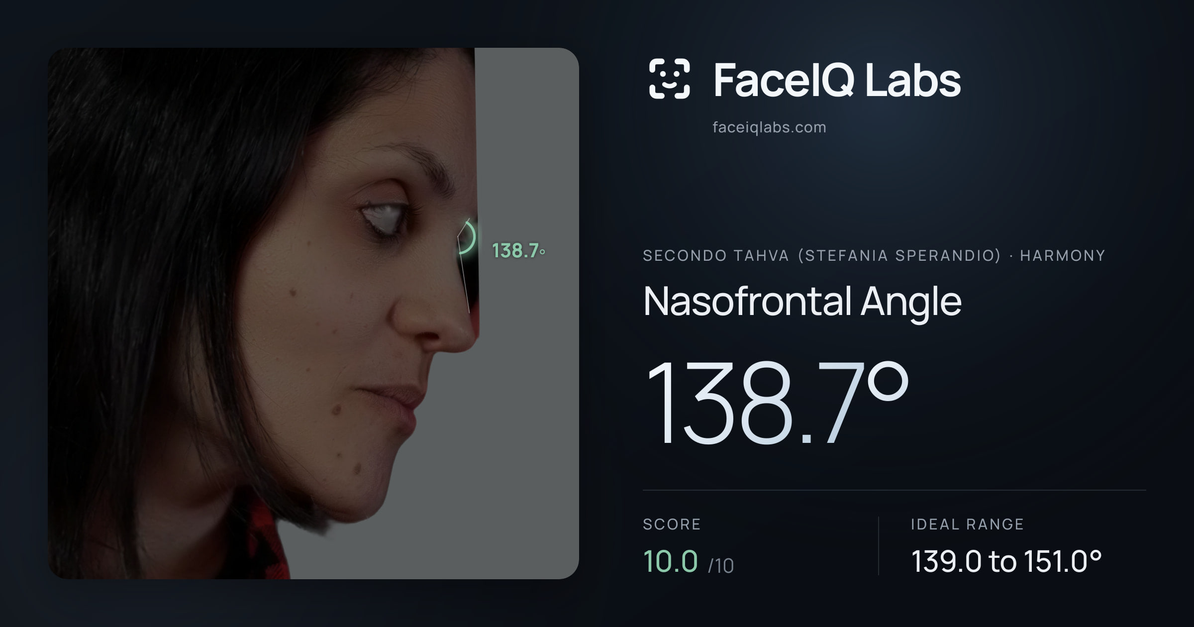 Secondo Tahva (Stefania Sperandio) Nasofrontal Angle: 138.7°, drawn on the photo