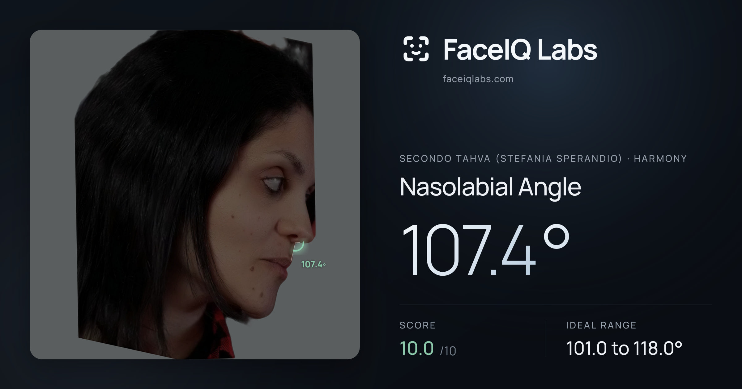 Secondo Tahva (Stefania Sperandio) Nasolabial Angle: 107.4°, drawn on the photo