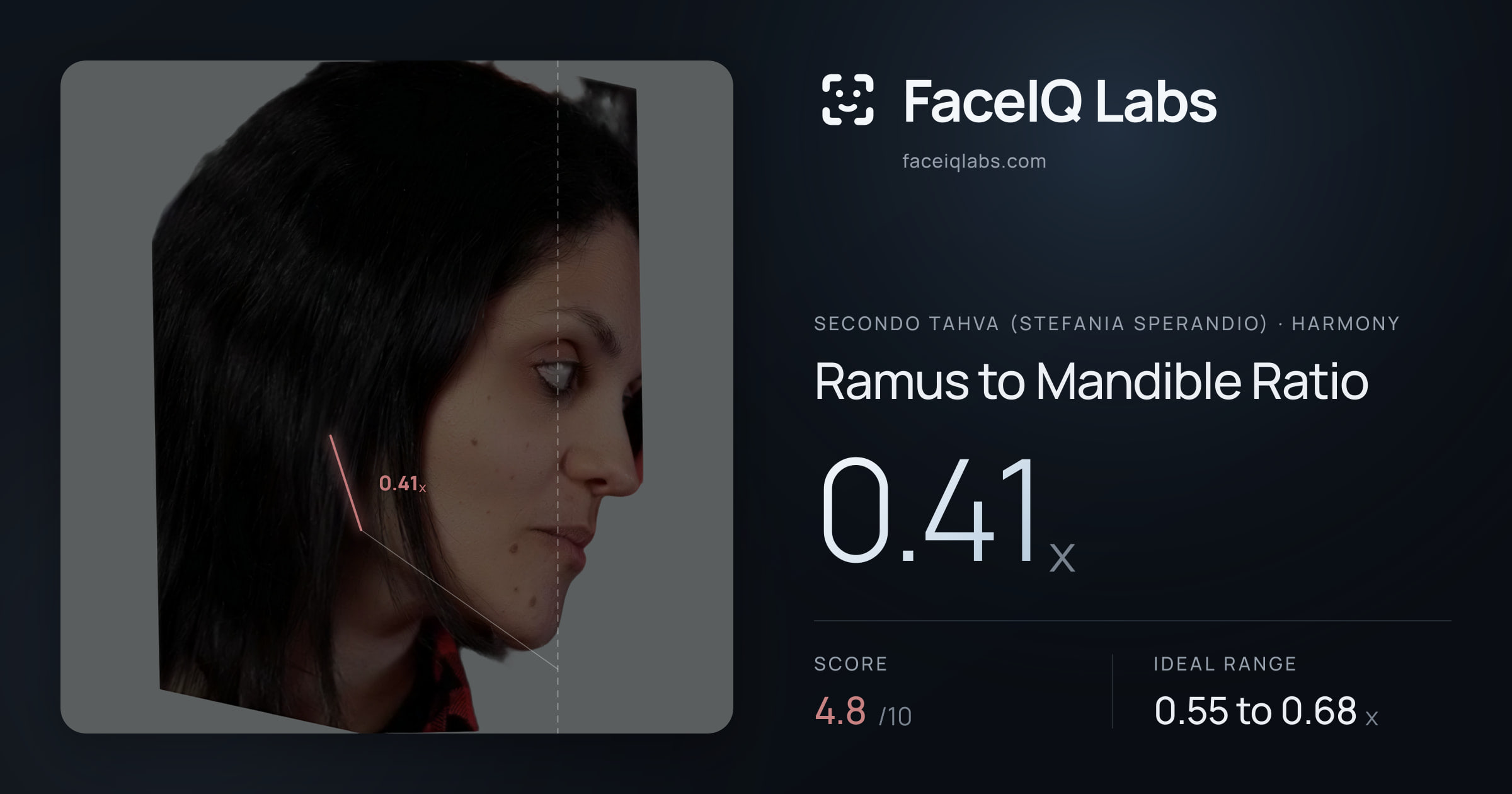 Secondo Tahva (Stefania Sperandio) Ramus to Mandible Ratio: 0.41x, drawn on the photo