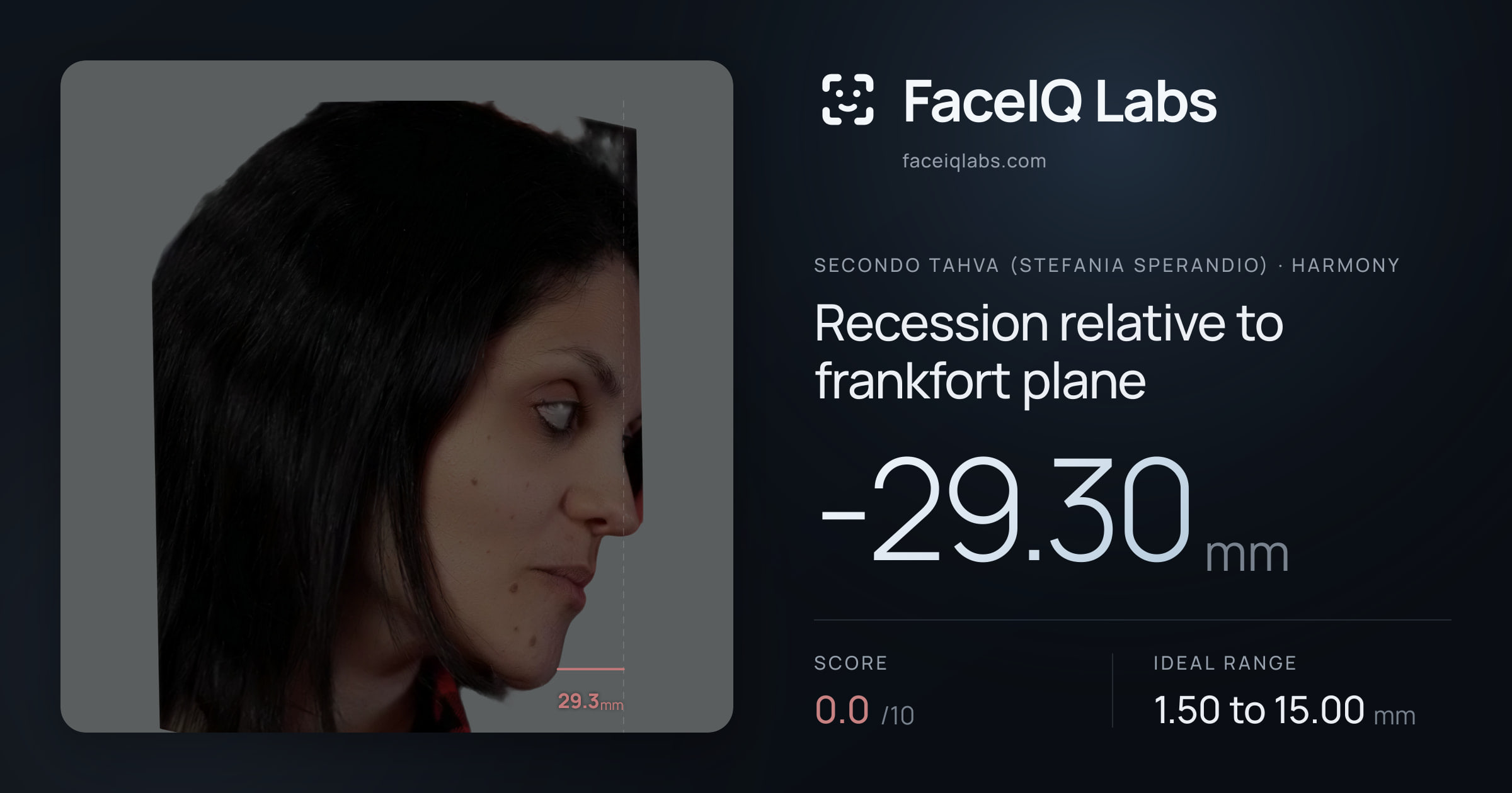 Secondo Tahva (Stefania Sperandio) Recession relative to frankfort plane: -29.30mm, drawn on the photo