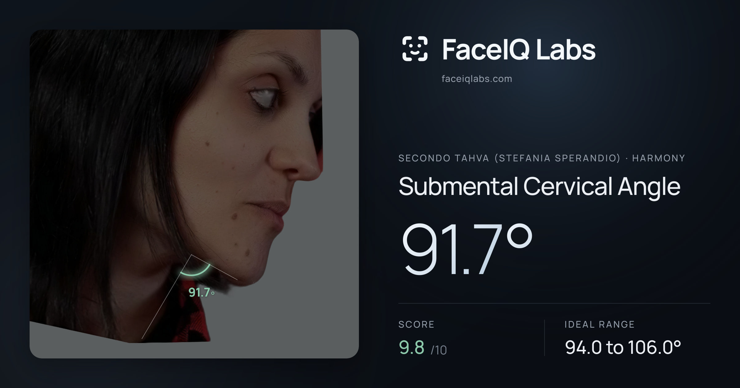 Secondo Tahva (Stefania Sperandio) Submental Cervical Angle: 91.7°, drawn on the photo