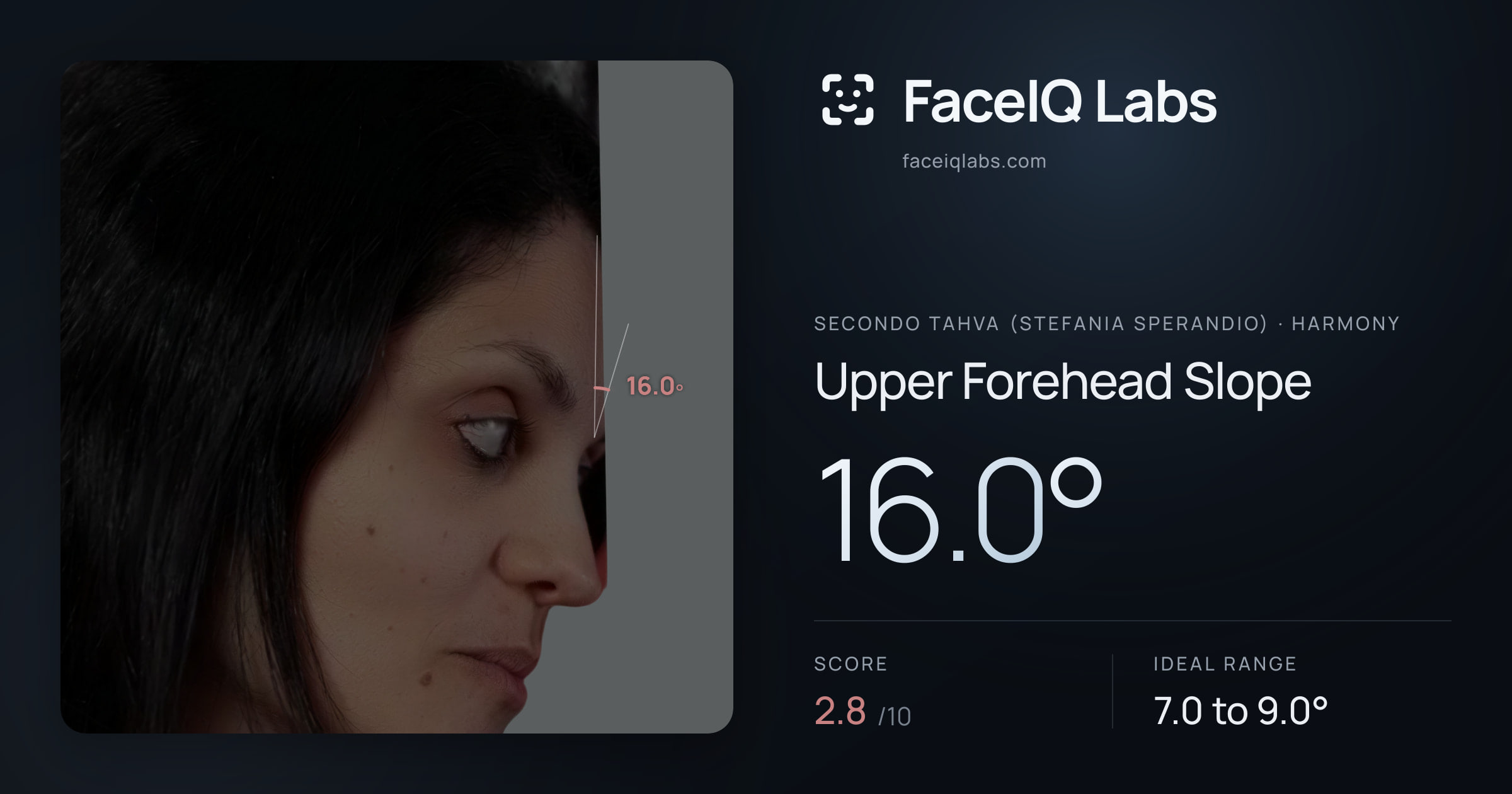 Secondo Tahva (Stefania Sperandio) Upper Forehead Slope: 16.0°, drawn on the photo