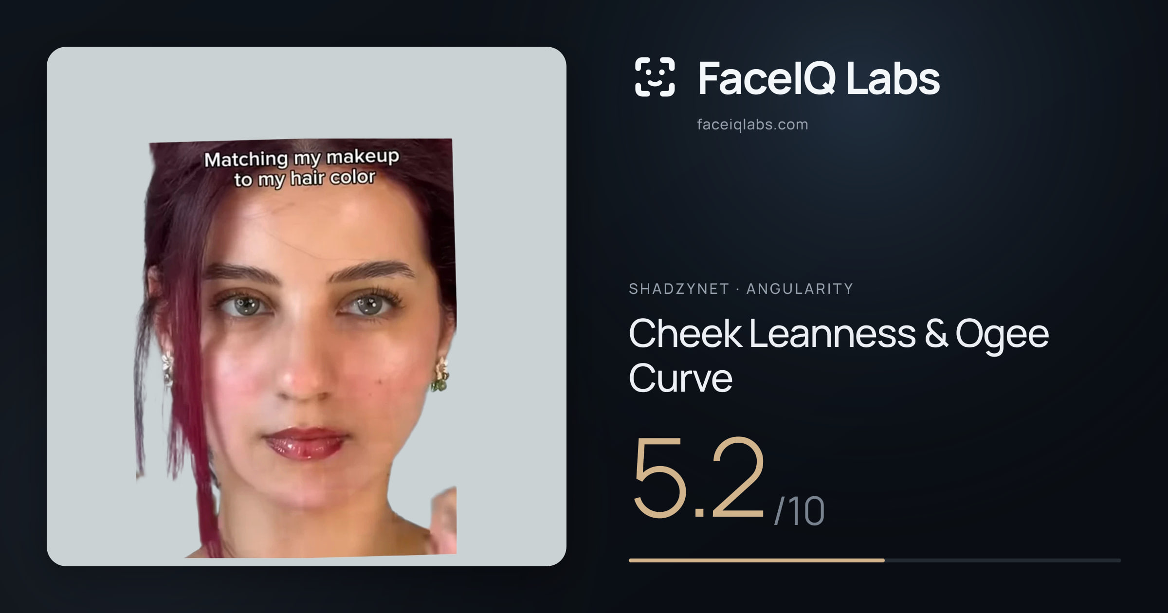 Shadzynet Cheek Leanness & Ogee Curve: 5.2/10, drawn on the photo