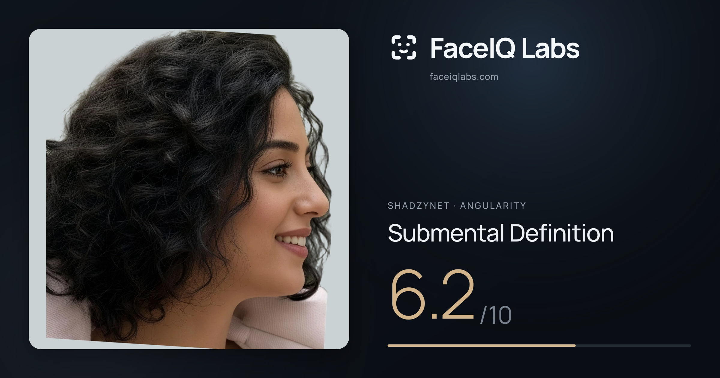 Shadzynet Submental Definition: 6.2/10, drawn on the photo
