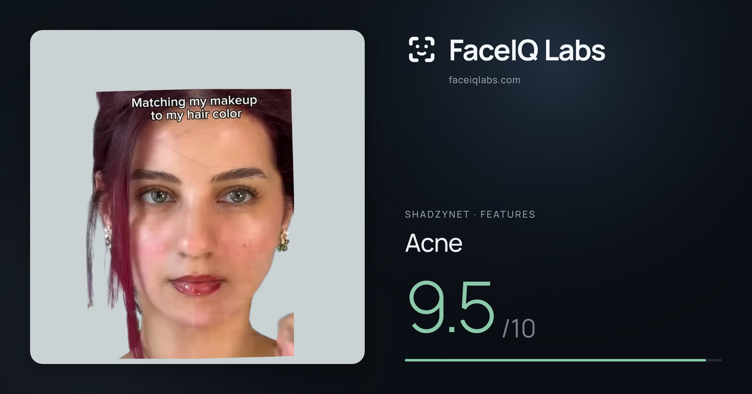 Shadzynet Acne: 9.5/10, drawn on the photo