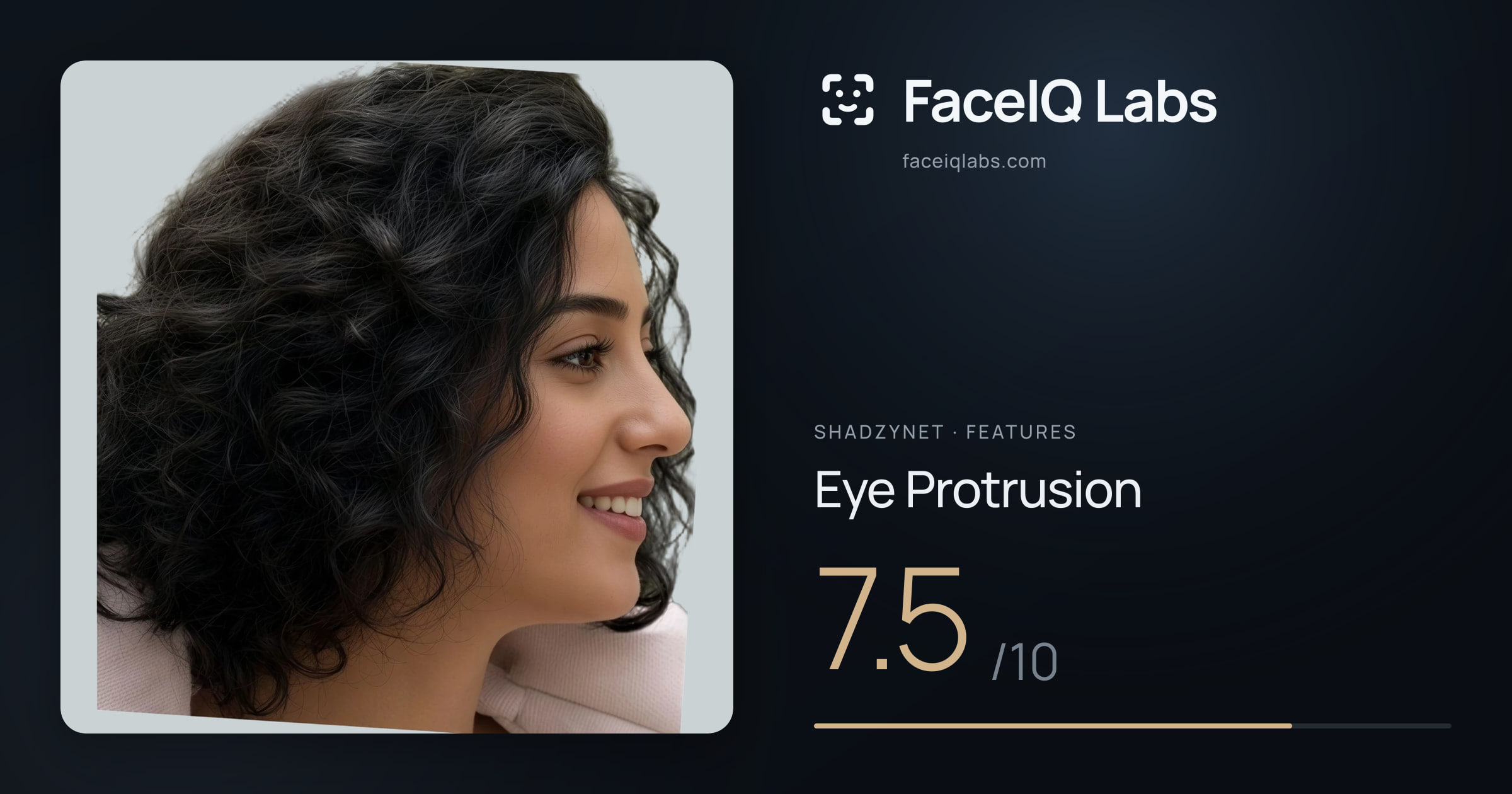 Shadzynet Eye Protrusion: 7.5/10, drawn on the photo