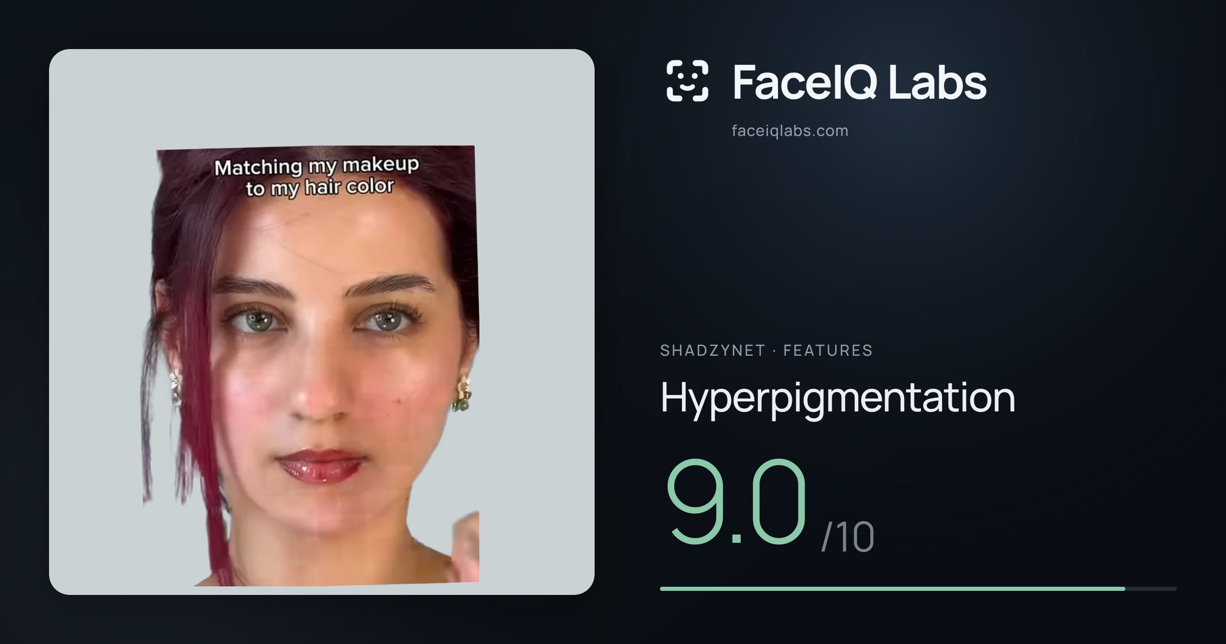 Shadzynet Hyperpigmentation: 9.0/10, drawn on the photo
