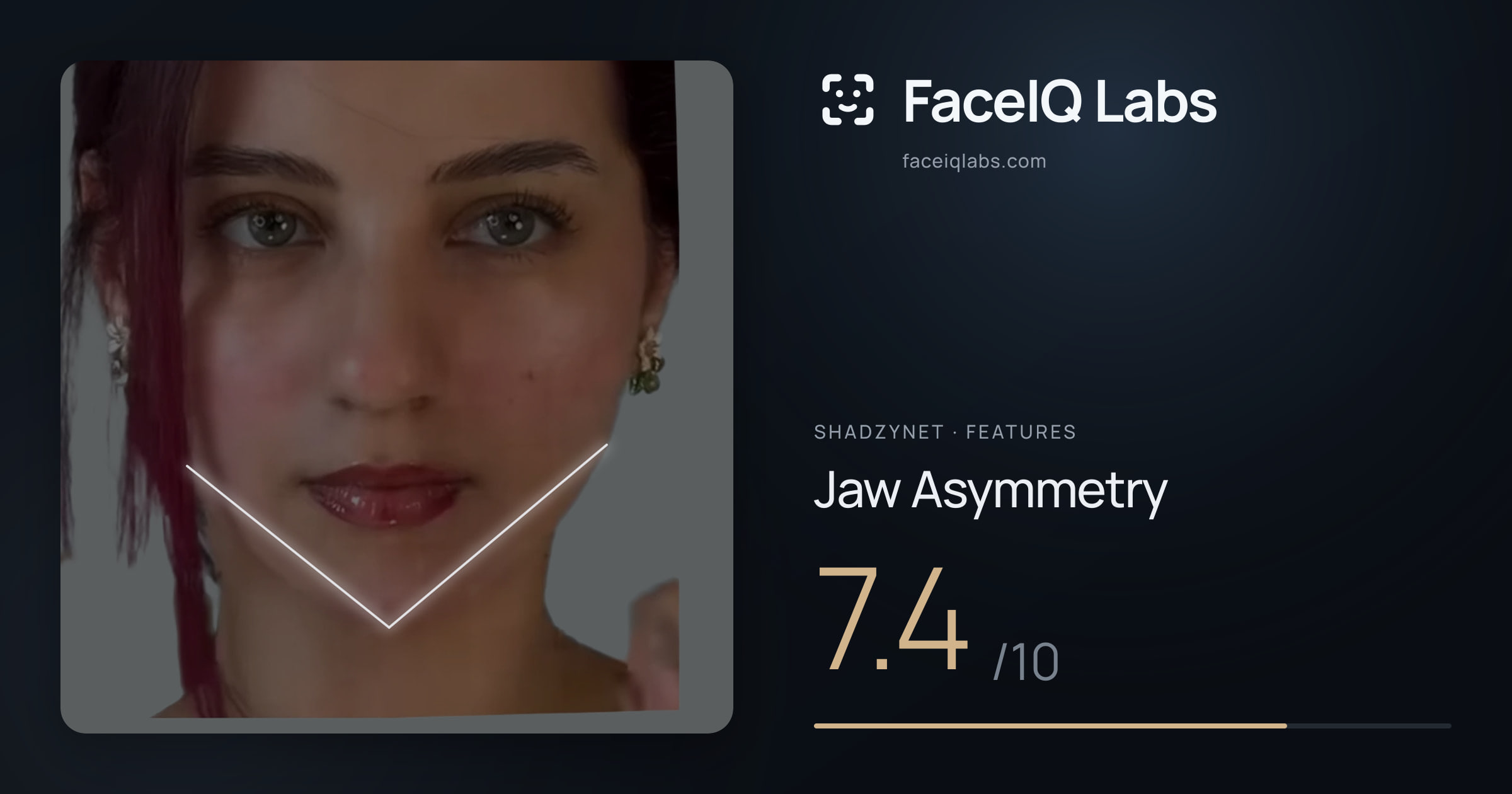 Shadzynet Jaw Asymmetry: 7.4/10, drawn on the photo