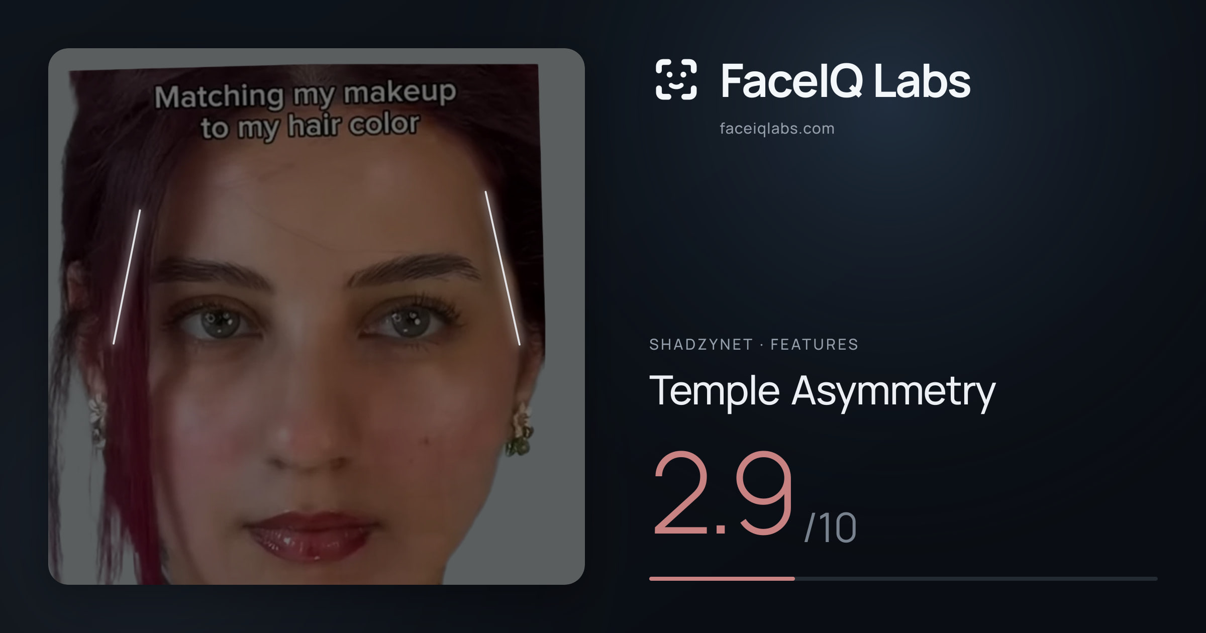 Shadzynet Temple Asymmetry: 2.9/10, drawn on the photo