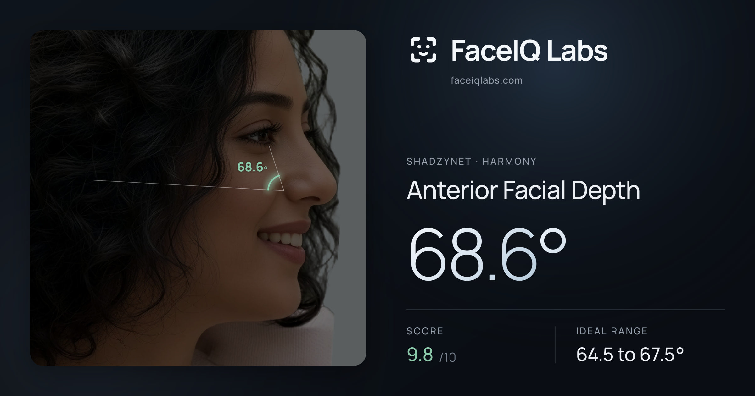 Shadzynet Anterior Facial Depth: 68.6°, drawn on the photo