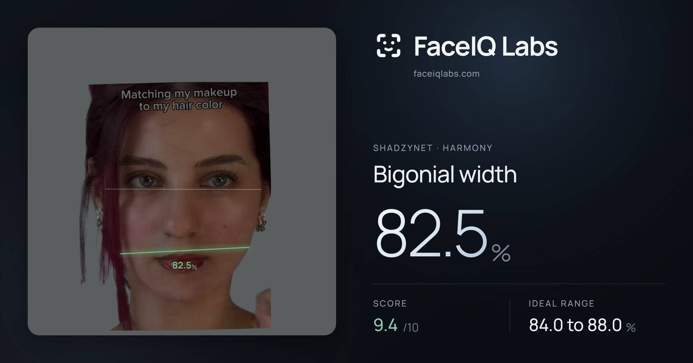 Shadzynet Bigonial width: 82.5%, drawn on the photo