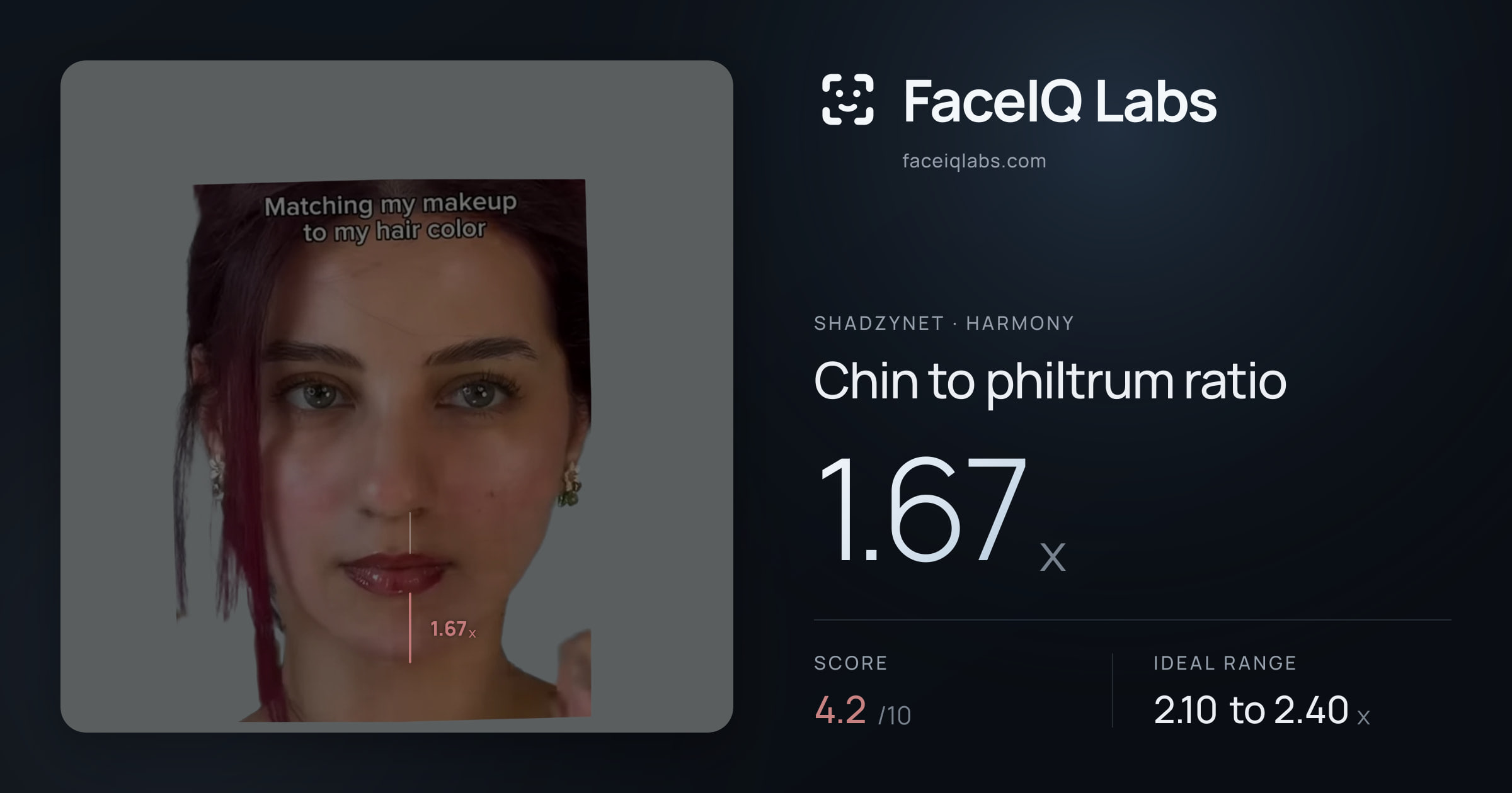 Shadzynet Chin to philtrum ratio: 1.67x, drawn on the photo