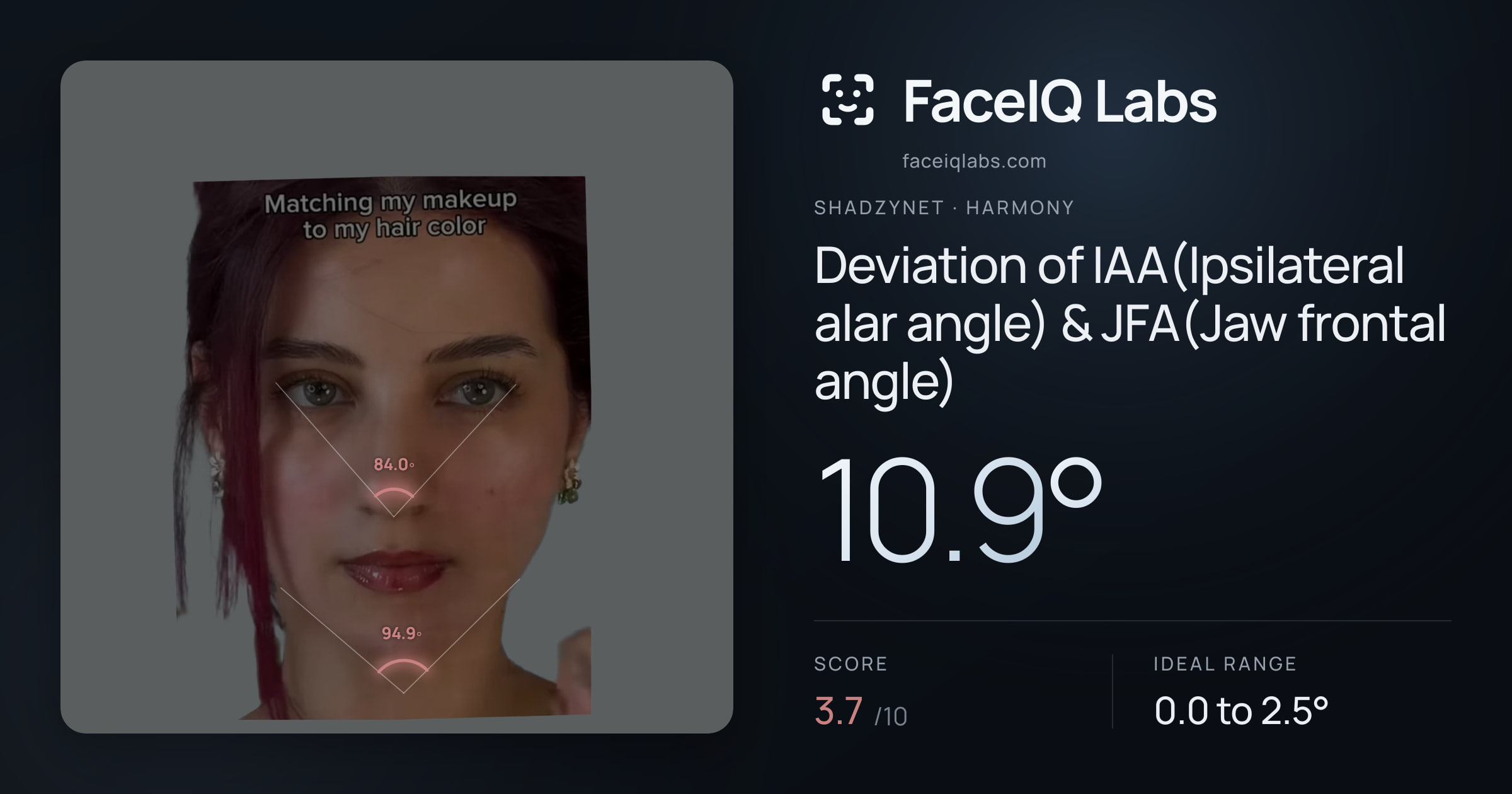 Shadzynet Deviation of IAA(Ipsilateral alar angle) & JFA(Jaw frontal angle): 10.9°, drawn on the photo
