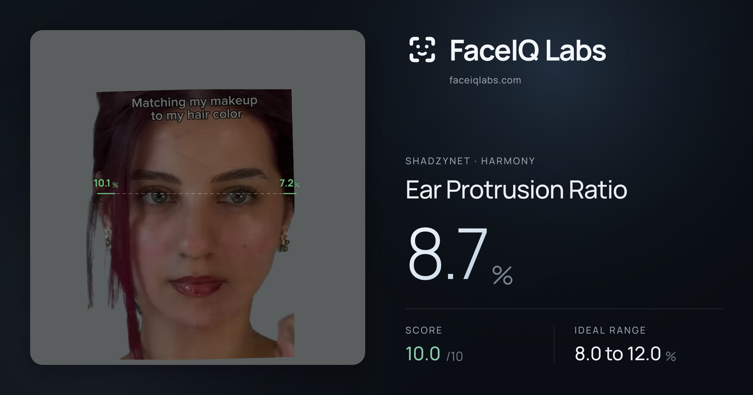 Shadzynet Ear Protrusion Ratio: 8.7%, drawn on the photo