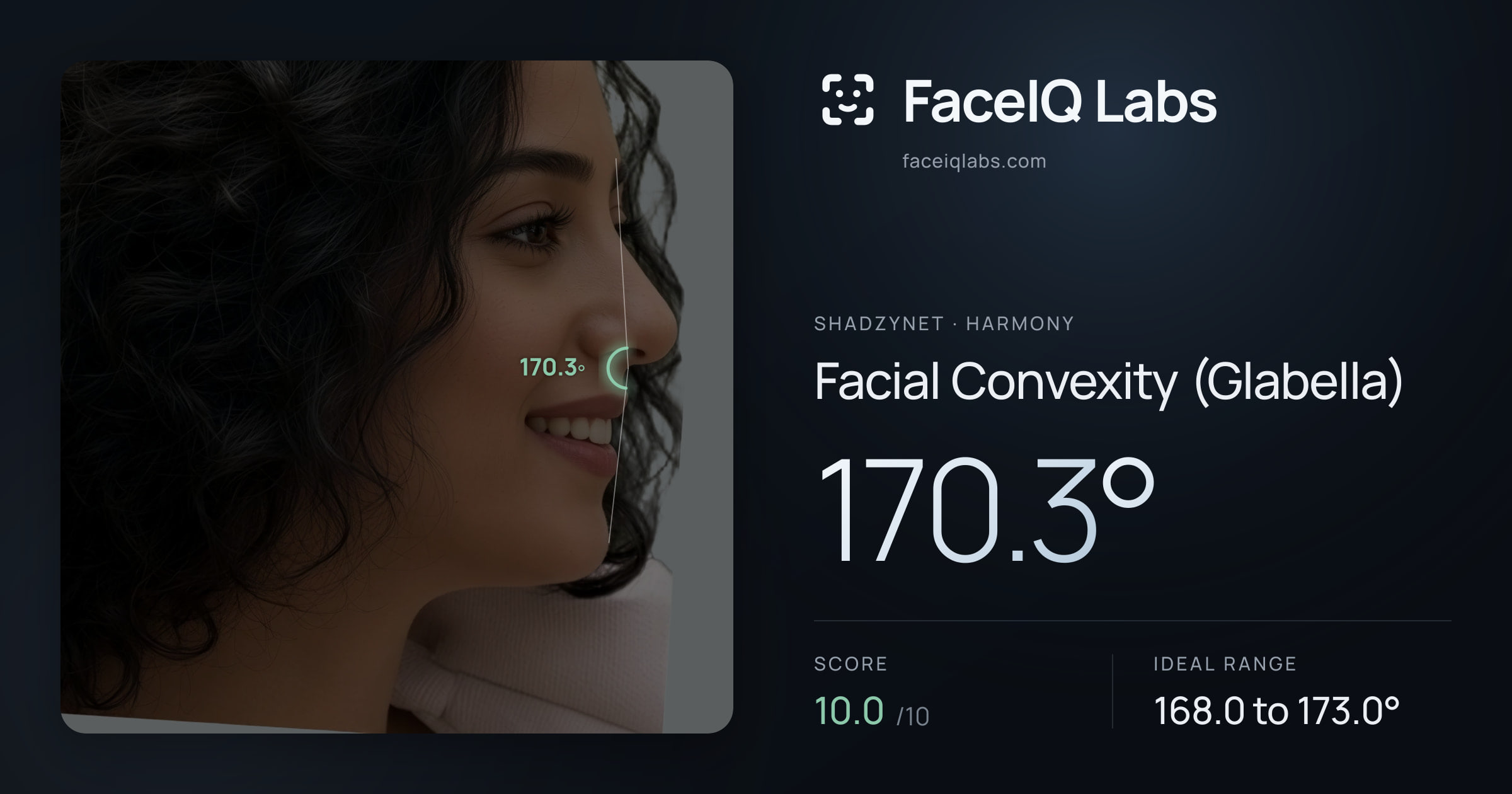 Shadzynet Facial Convexity (Glabella): 170.3°, drawn on the photo
