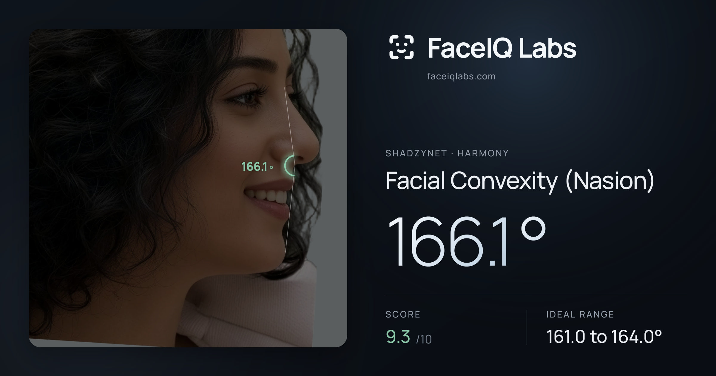 Shadzynet Facial Convexity (Nasion): 166.1°, drawn on the photo