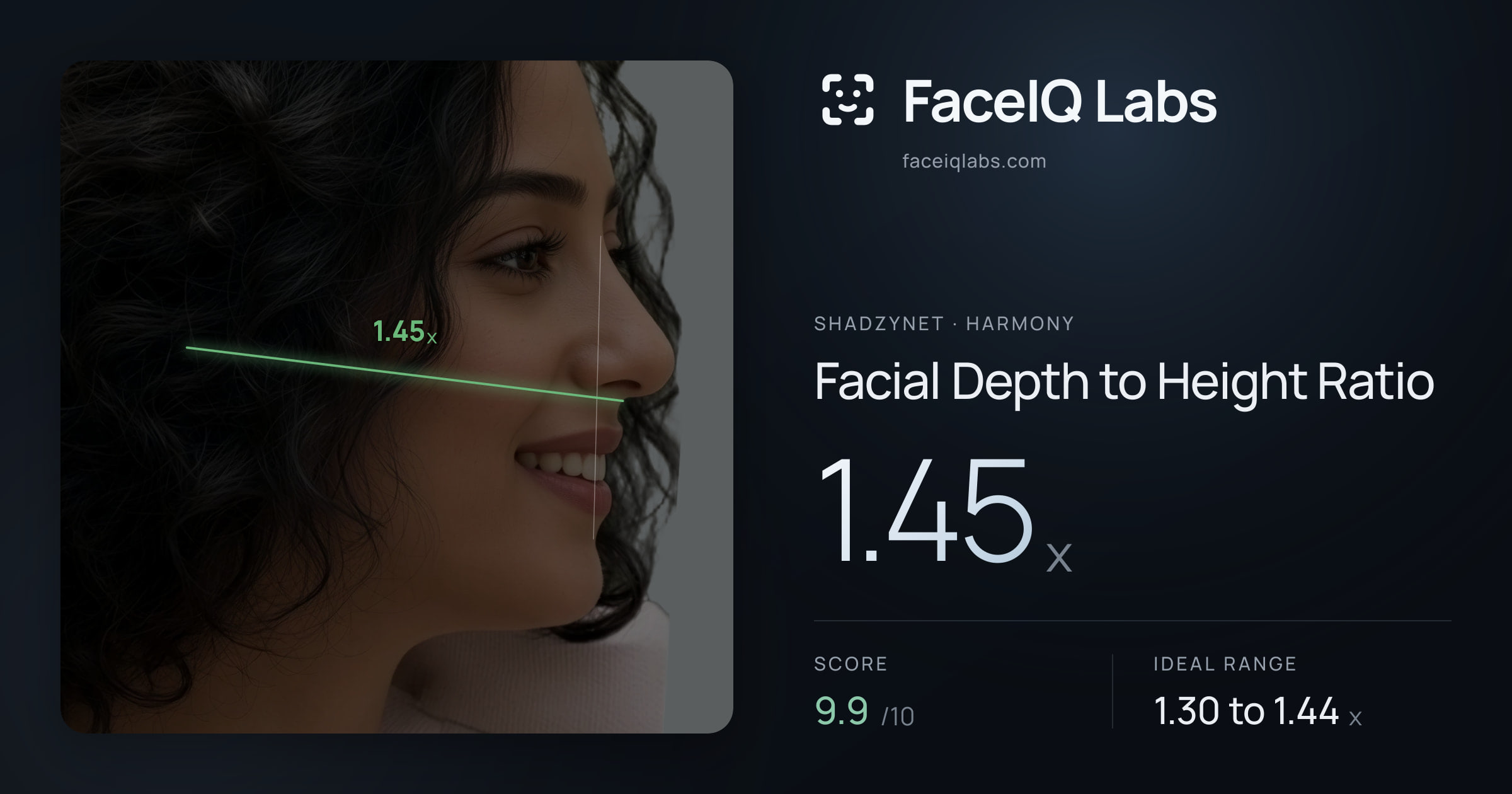 Shadzynet Facial Depth to Height Ratio: 1.45x, drawn on the photo