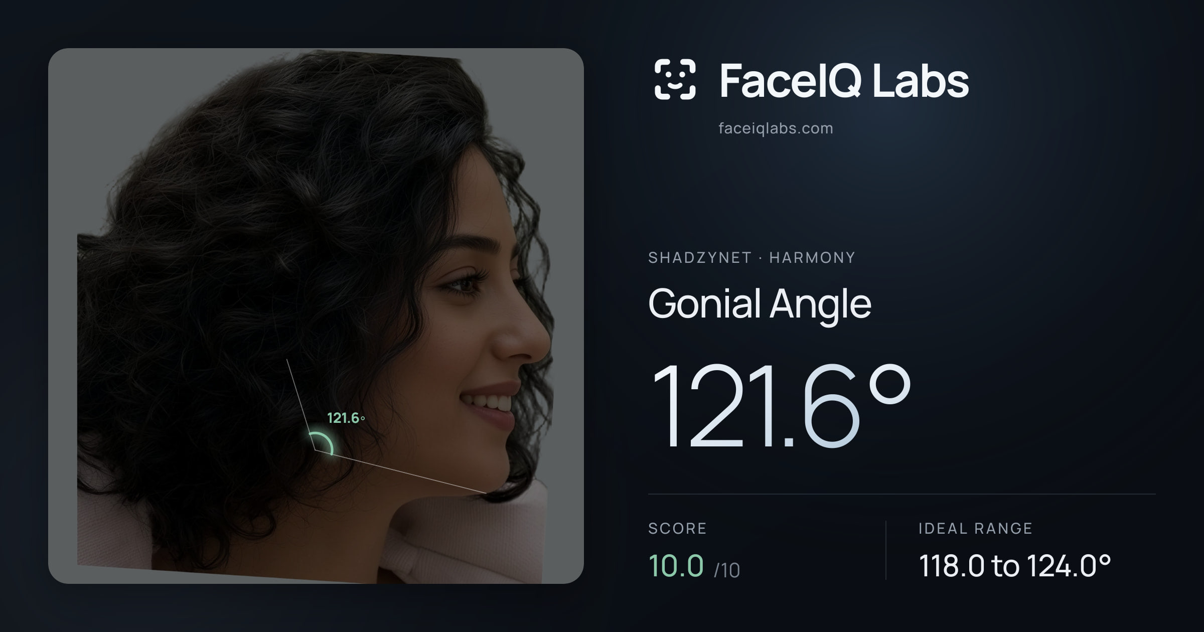 Shadzynet Gonial Angle: 121.6°, drawn on the photo
