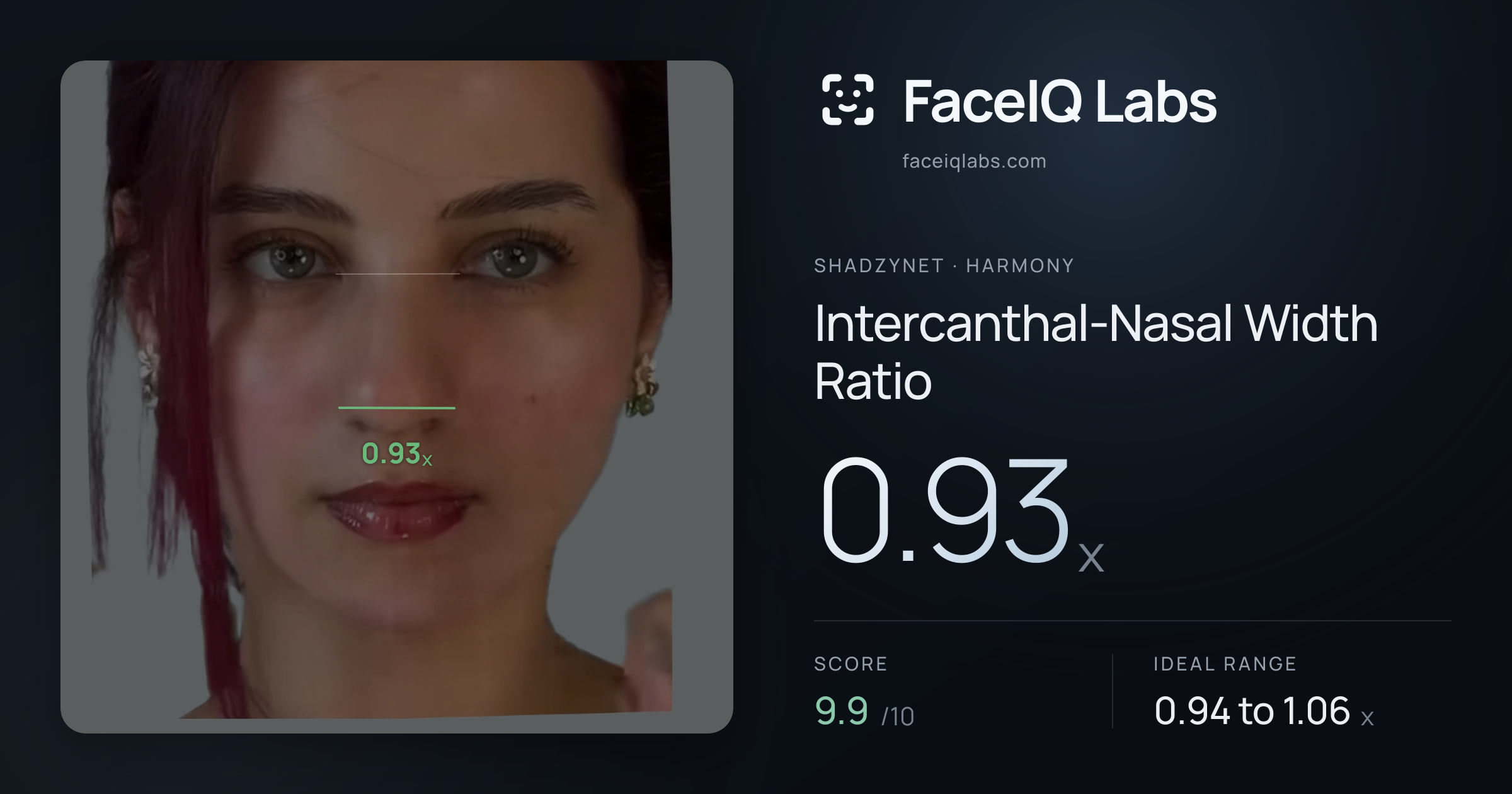 Shadzynet Intercanthal-Nasal Width Ratio: 0.93x, drawn on the photo