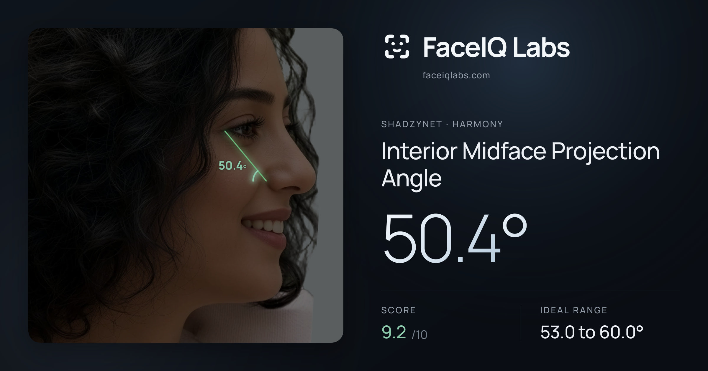 Shadzynet Interior Midface Projection Angle: 50.4°, drawn on the photo