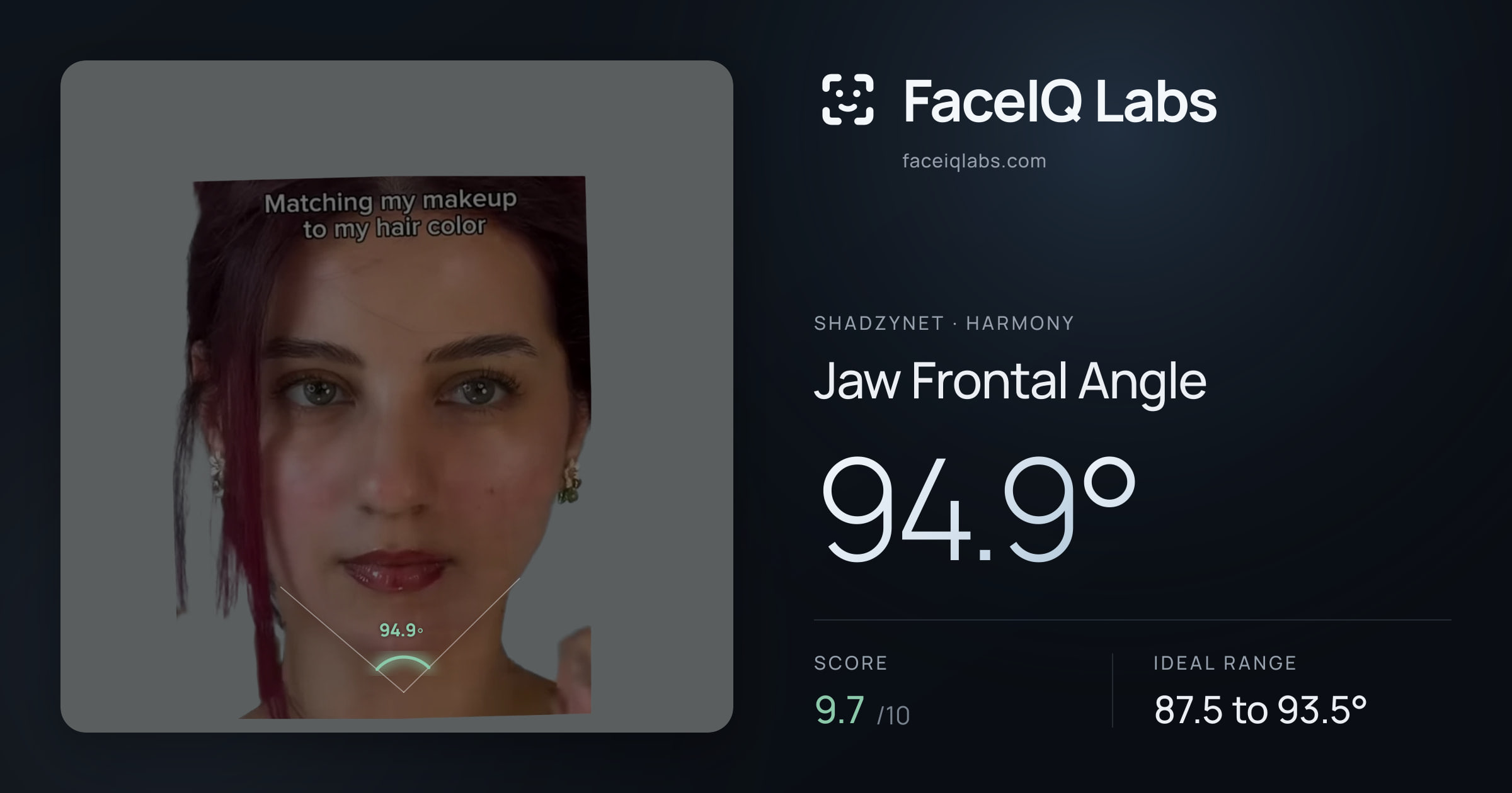 Shadzynet Jaw Frontal Angle: 94.9°, drawn on the photo