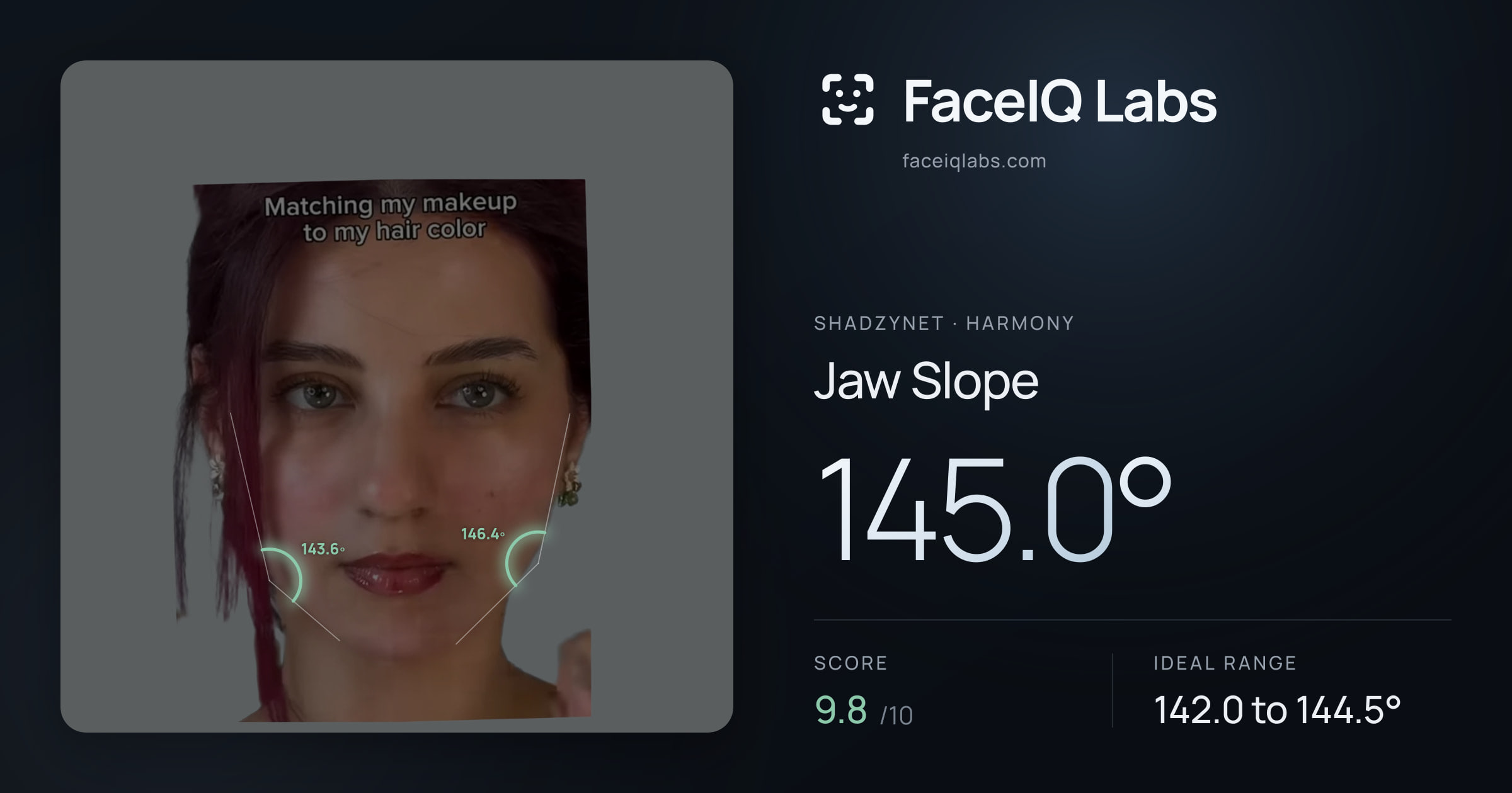 Shadzynet Jaw Slope: 145.0°, drawn on the photo