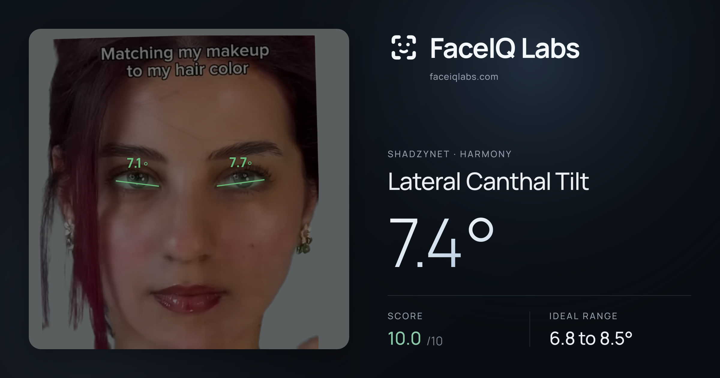 Shadzynet Lateral Canthal Tilt: 7.4°, drawn on the photo
