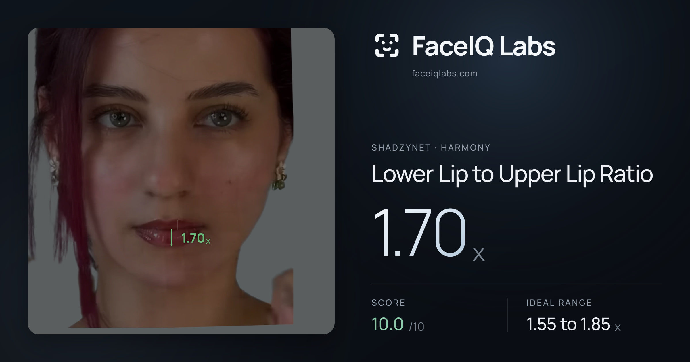 Shadzynet Lower Lip to Upper Lip Ratio: 1.70x, drawn on the photo