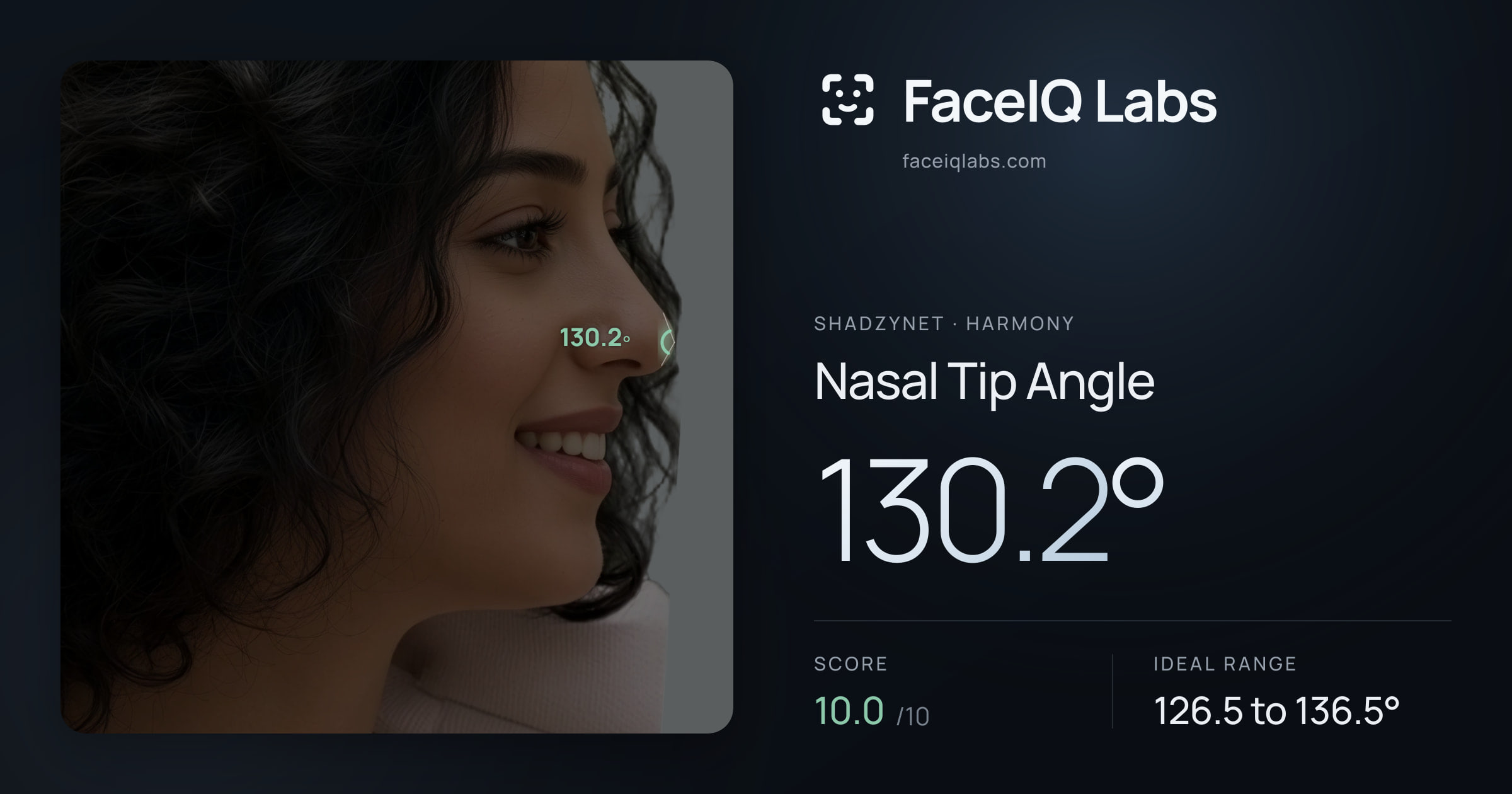 Shadzynet Nasal Tip Angle: 130.2°, drawn on the photo
