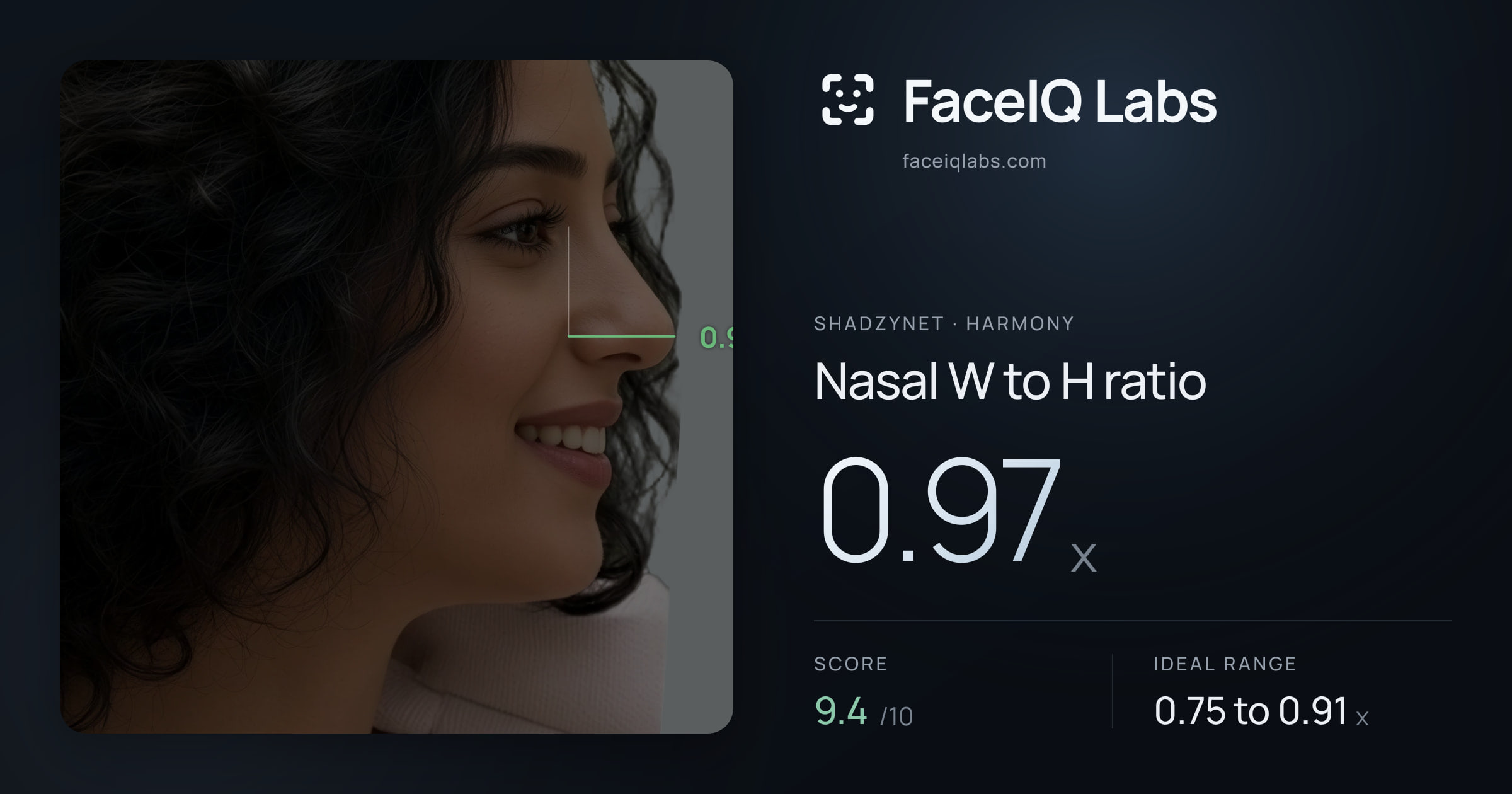 Shadzynet Nasal W to H ratio: 0.97x, drawn on the photo