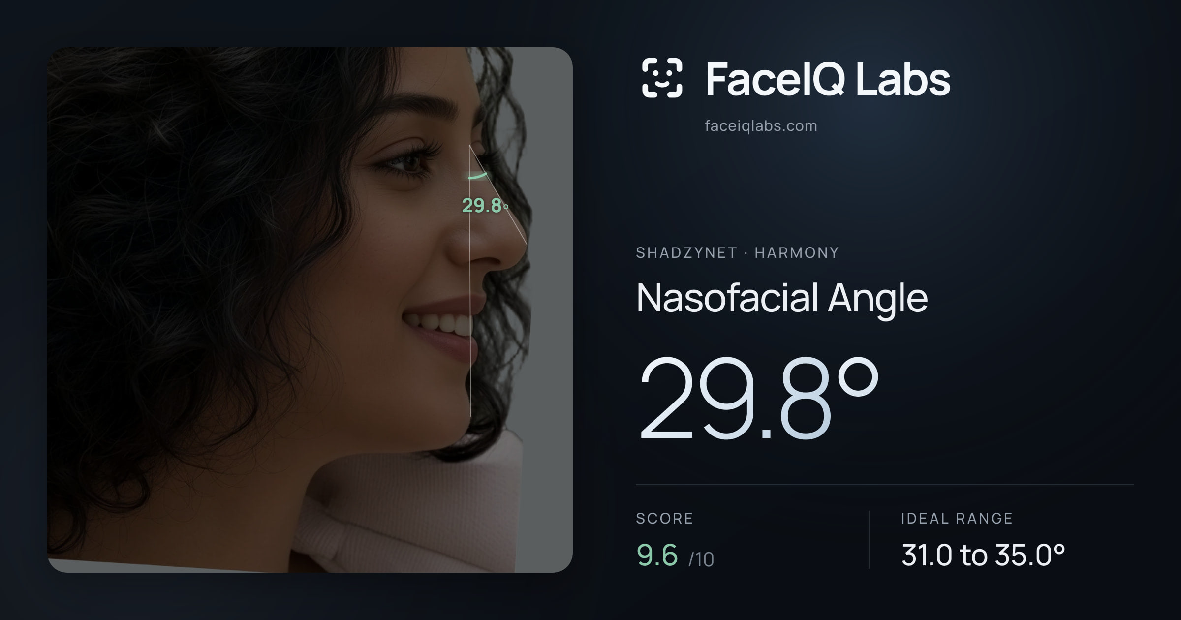 Shadzynet Nasofacial Angle: 29.8°, drawn on the photo