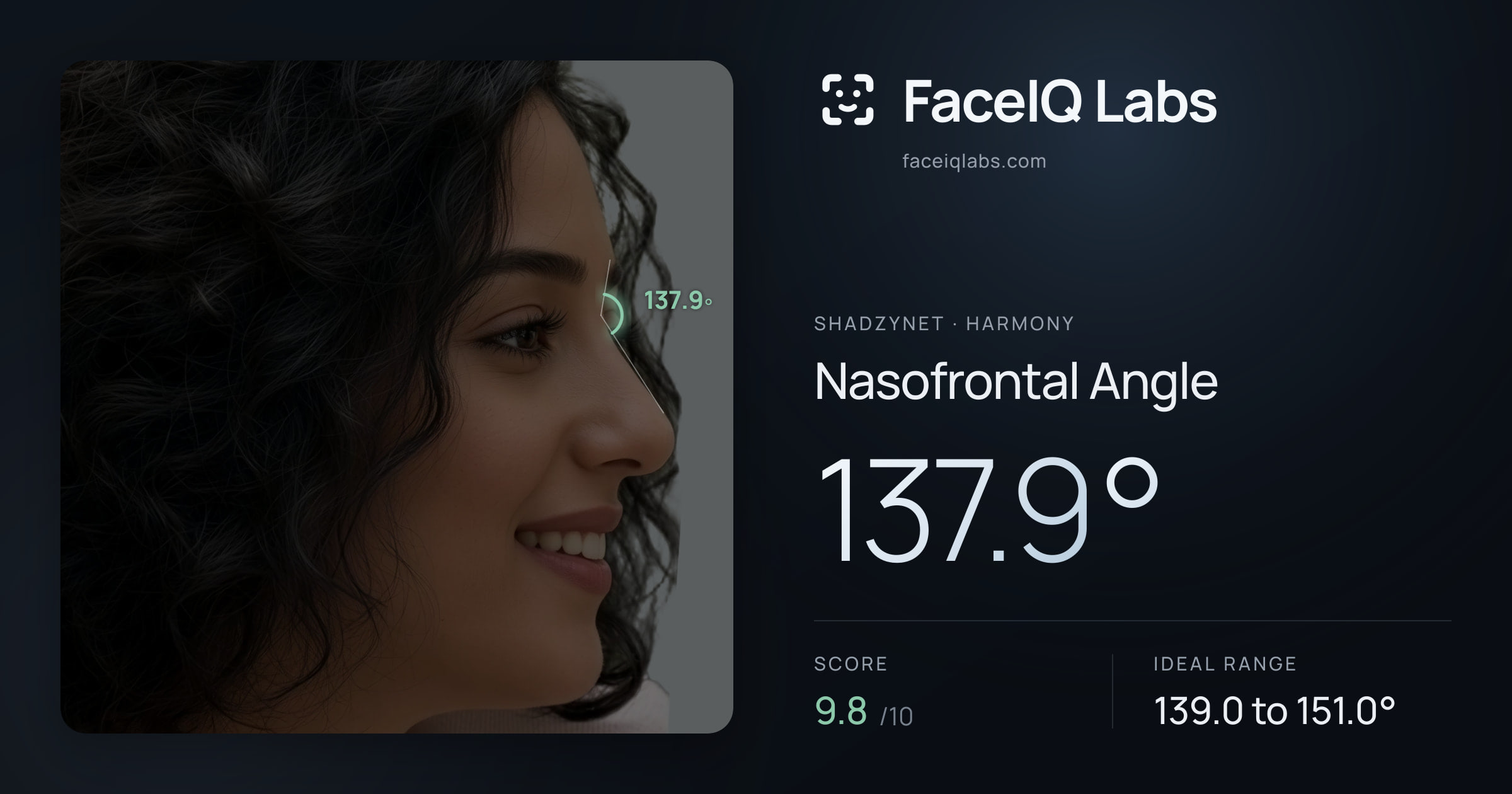 Shadzynet Nasofrontal Angle: 137.9°, drawn on the photo