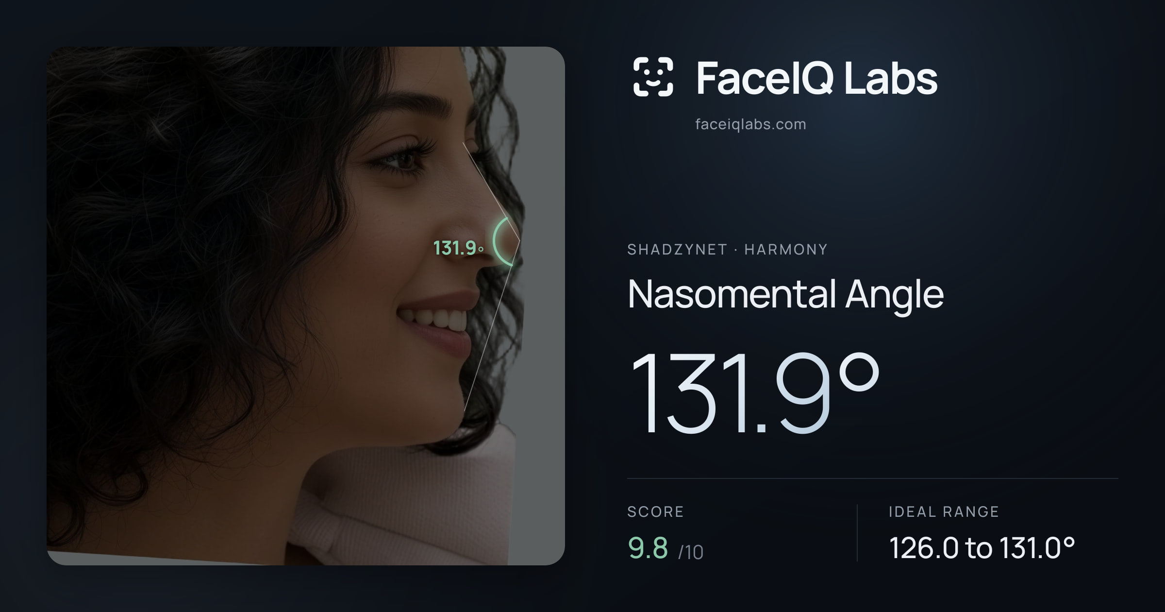 Shadzynet Nasomental Angle: 131.9°, drawn on the photo