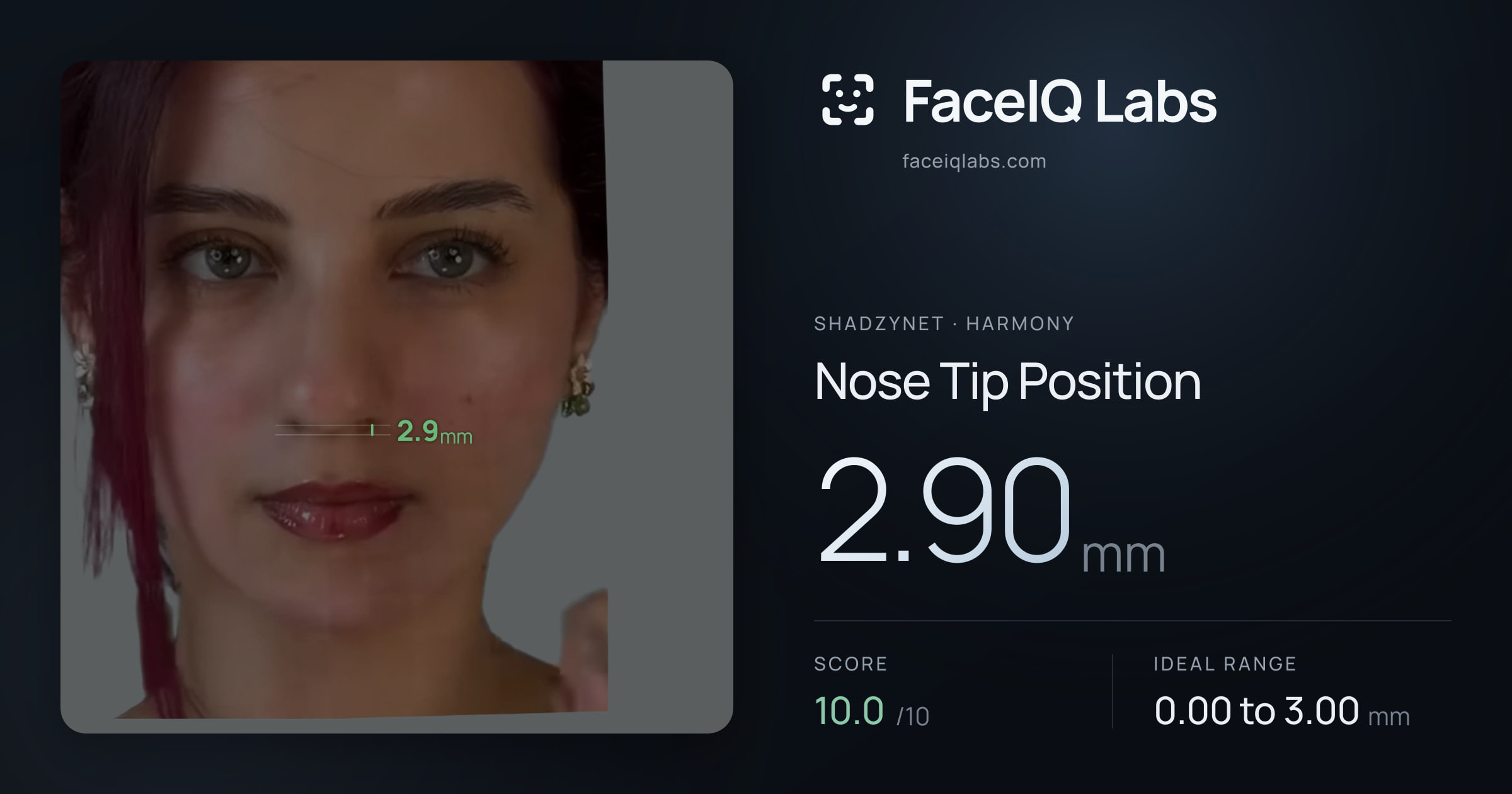 Shadzynet Nose Tip Position: 2.90mm, drawn on the photo