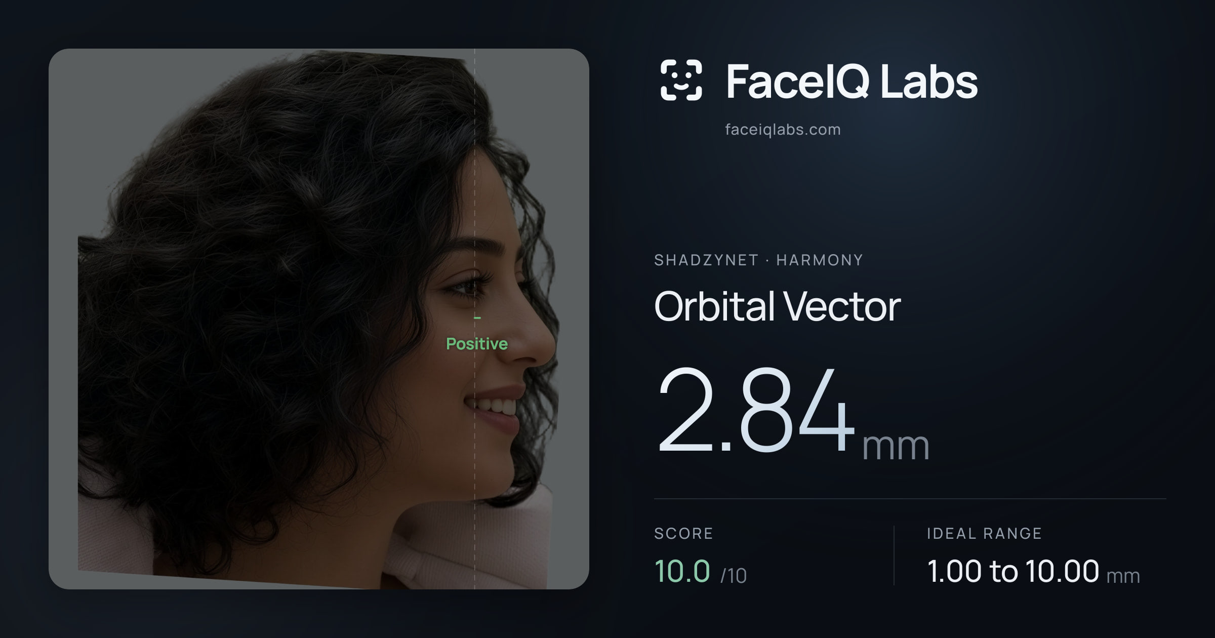 Shadzynet Orbital Vector: 2.84mm, drawn on the photo