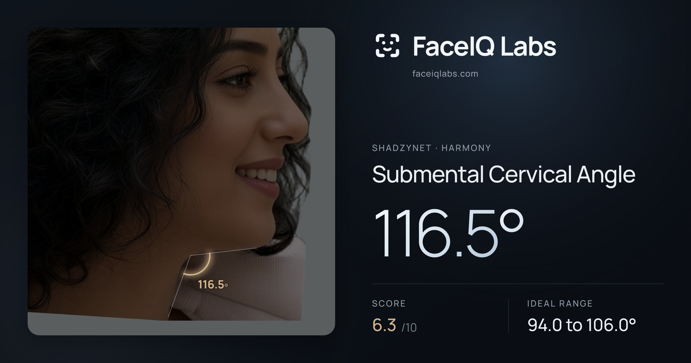 Shadzynet Submental Cervical Angle: 116.5°, drawn on the photo