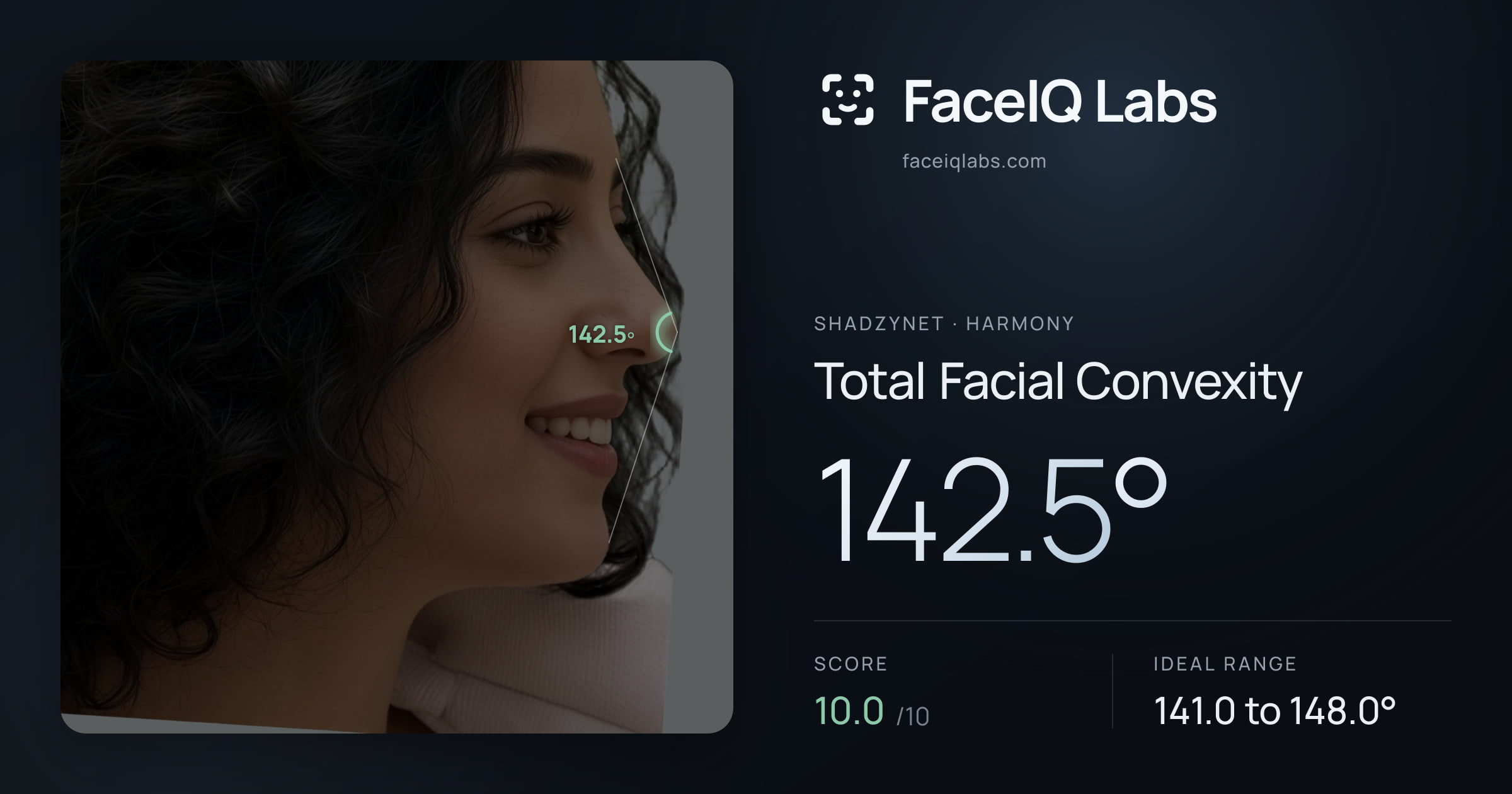 Shadzynet Total Facial Convexity: 142.5°, drawn on the photo