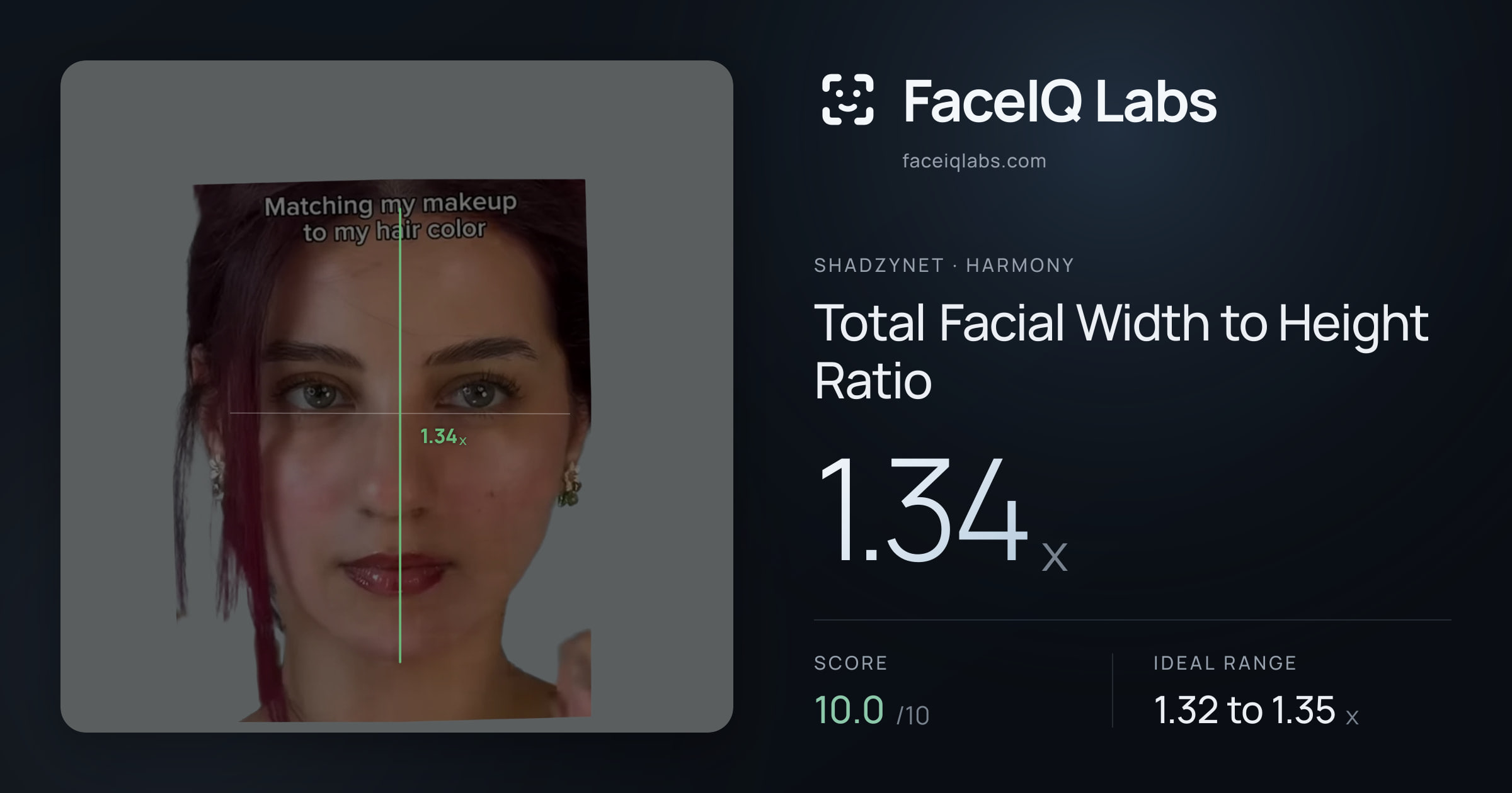 Shadzynet Total Facial Width to Height Ratio: 1.34x, drawn on the photo