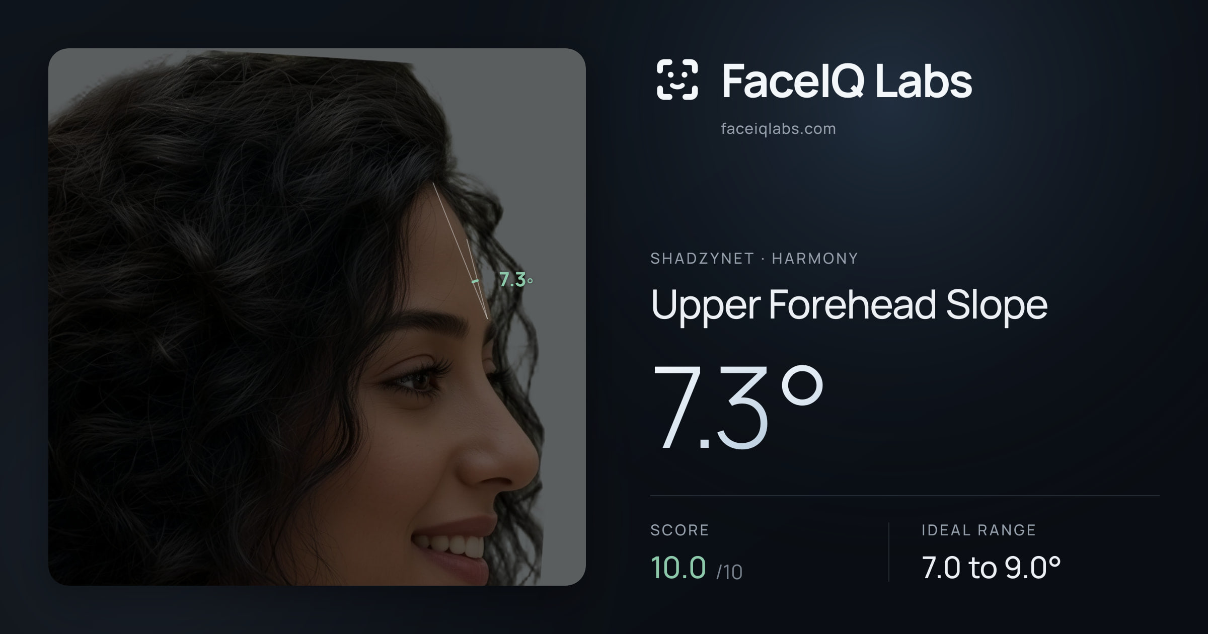 Shadzynet Upper Forehead Slope: 7.3°, drawn on the photo