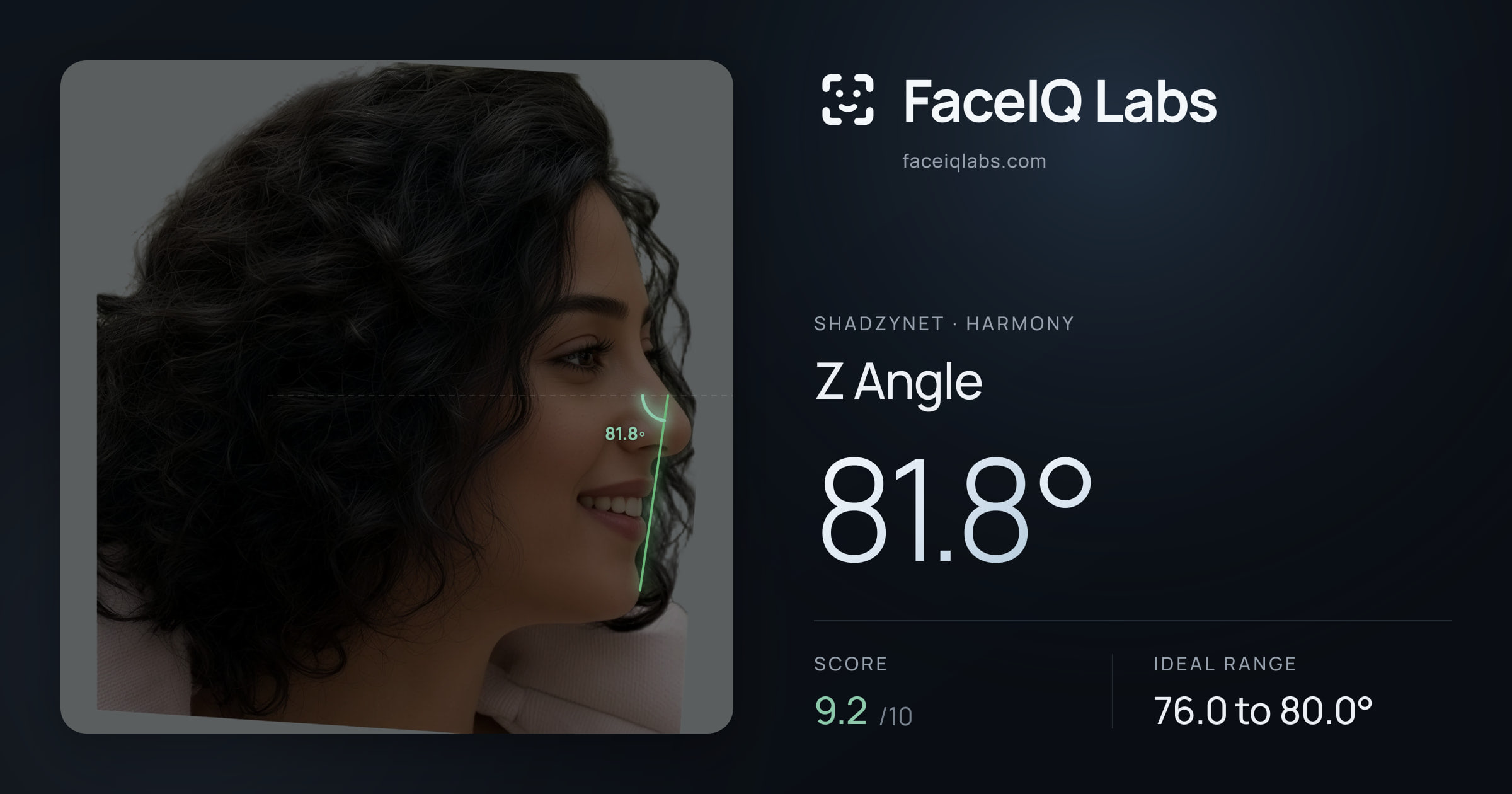 Shadzynet Z Angle: 81.8°, drawn on the photo