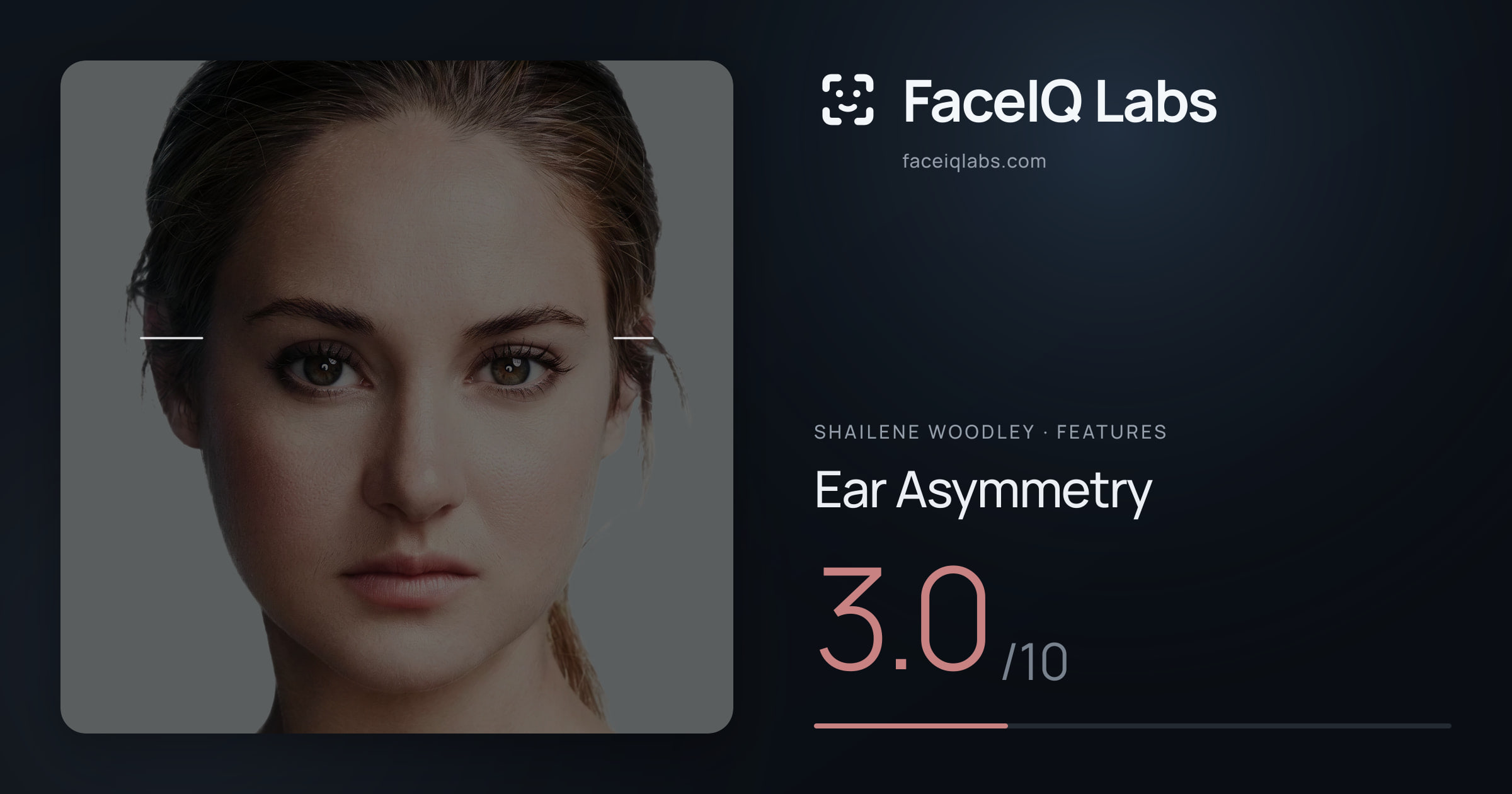 Shailene Woodley Ear Asymmetry: 3.0/10, drawn on the photo
