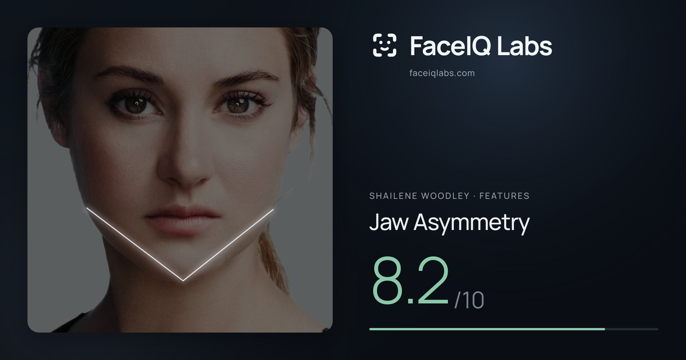Shailene Woodley Jaw Asymmetry: 8.2/10, drawn on the photo