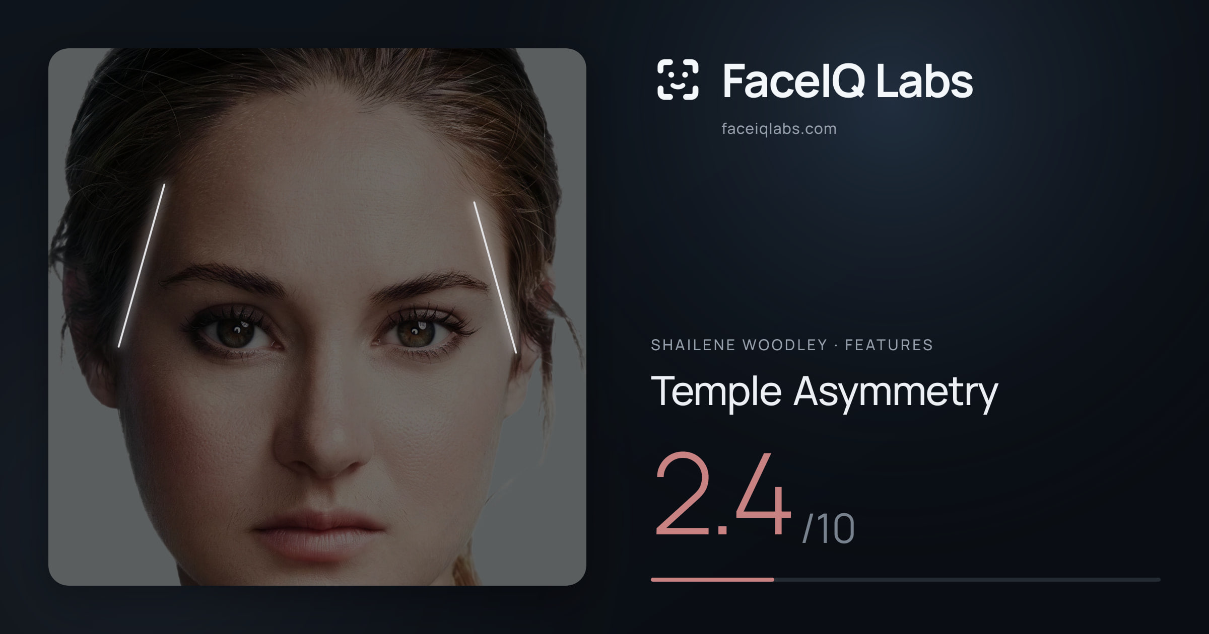 Shailene Woodley Temple Asymmetry: 2.4/10, drawn on the photo